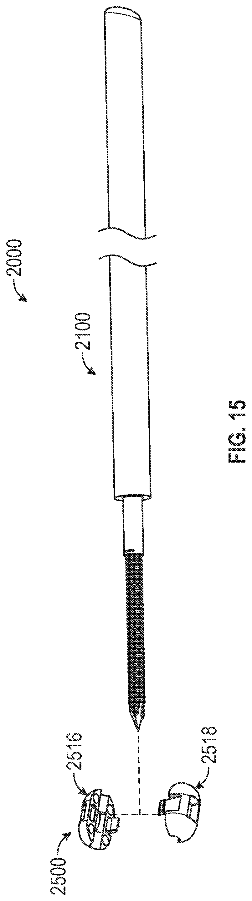 Patent US12310640 Figure 10 – Bone fixation devices, systems, kits, and methods