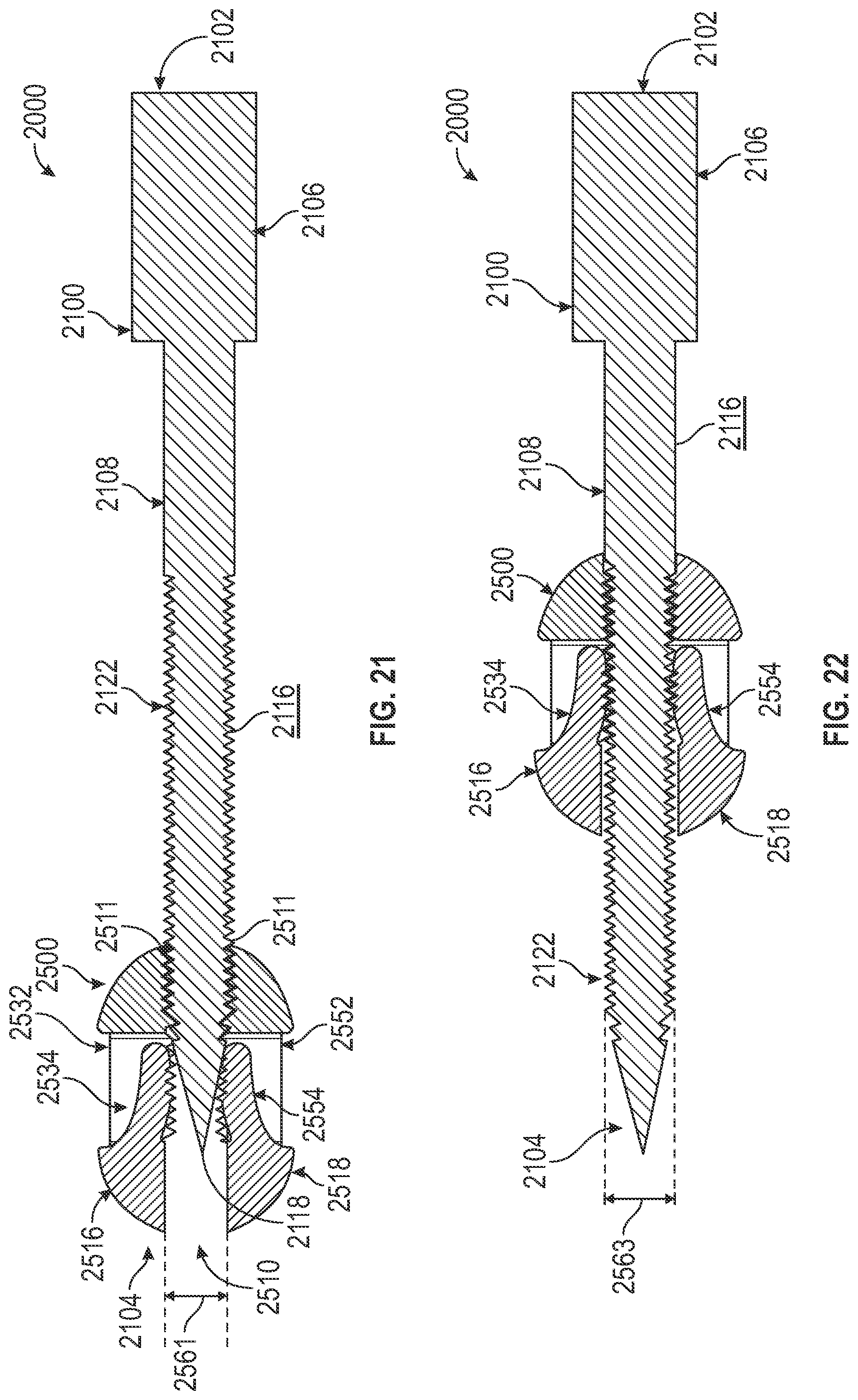Patent US12310640 Figure 13 – Bone fixation devices, systems, kits, and methods