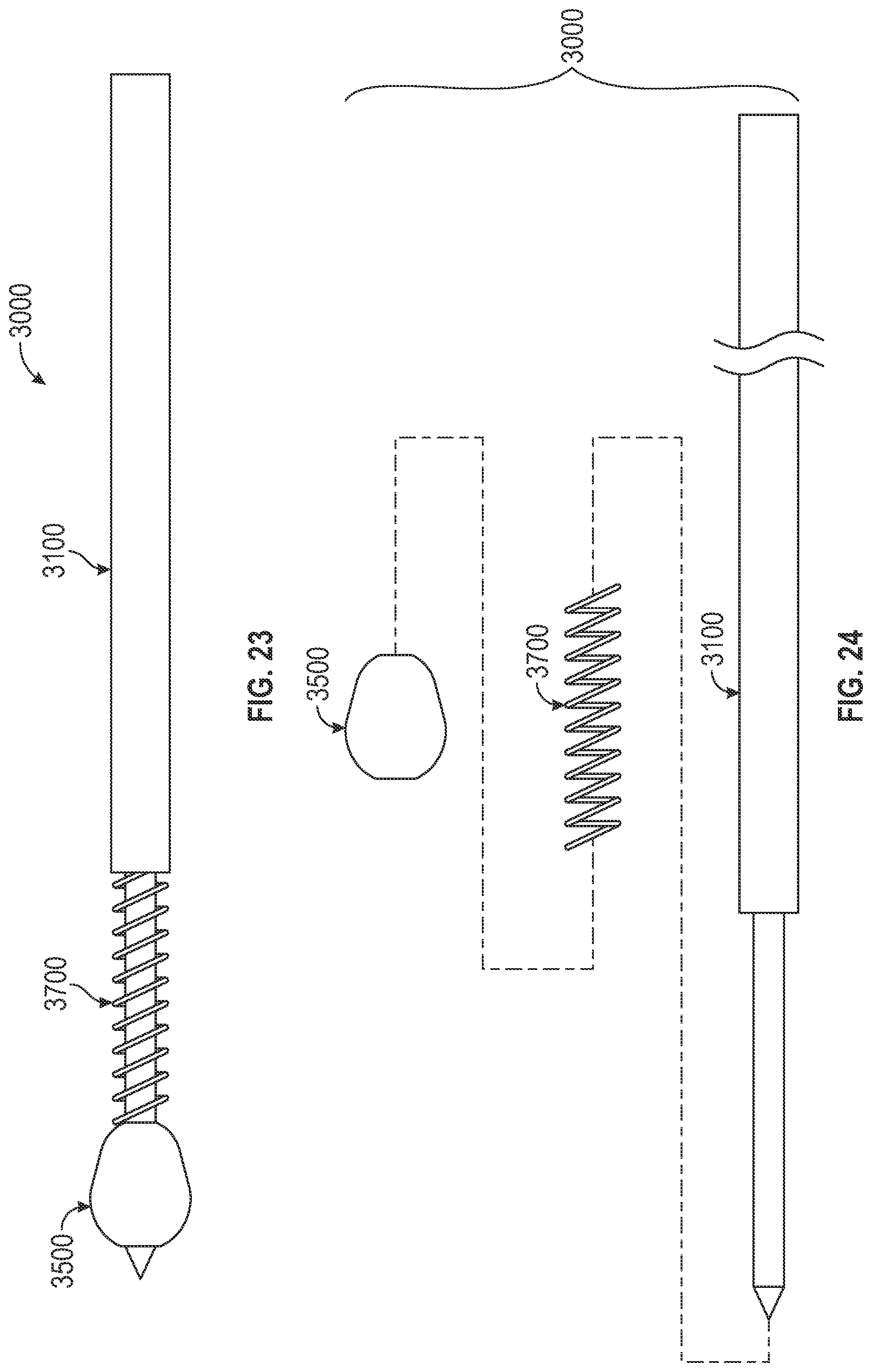 Patent US12310640 Figure 14 – Bone fixation devices, systems, kits, and methods