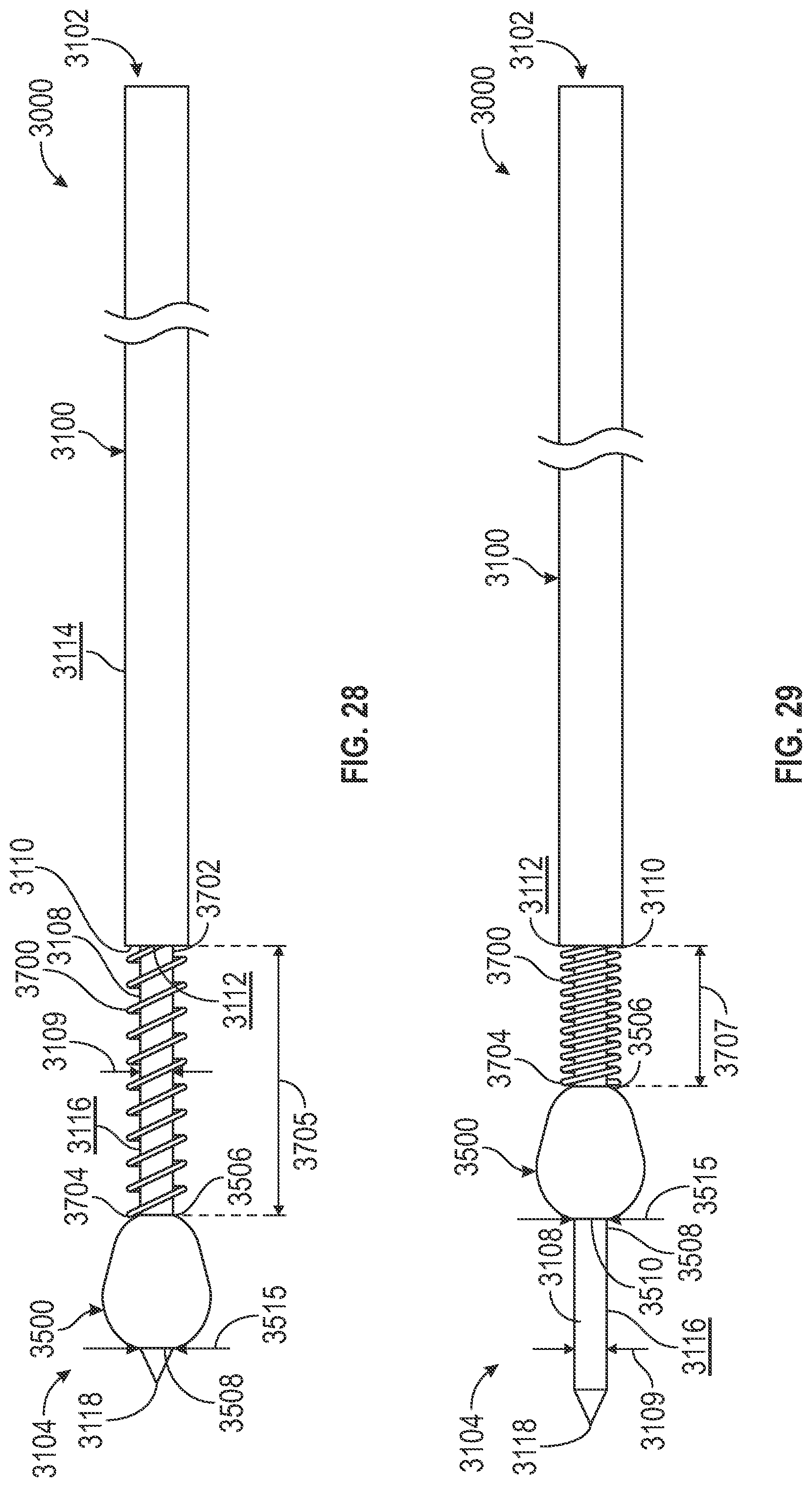 Patent US12310640 Figure 16 – Bone fixation devices, systems, kits, and methods