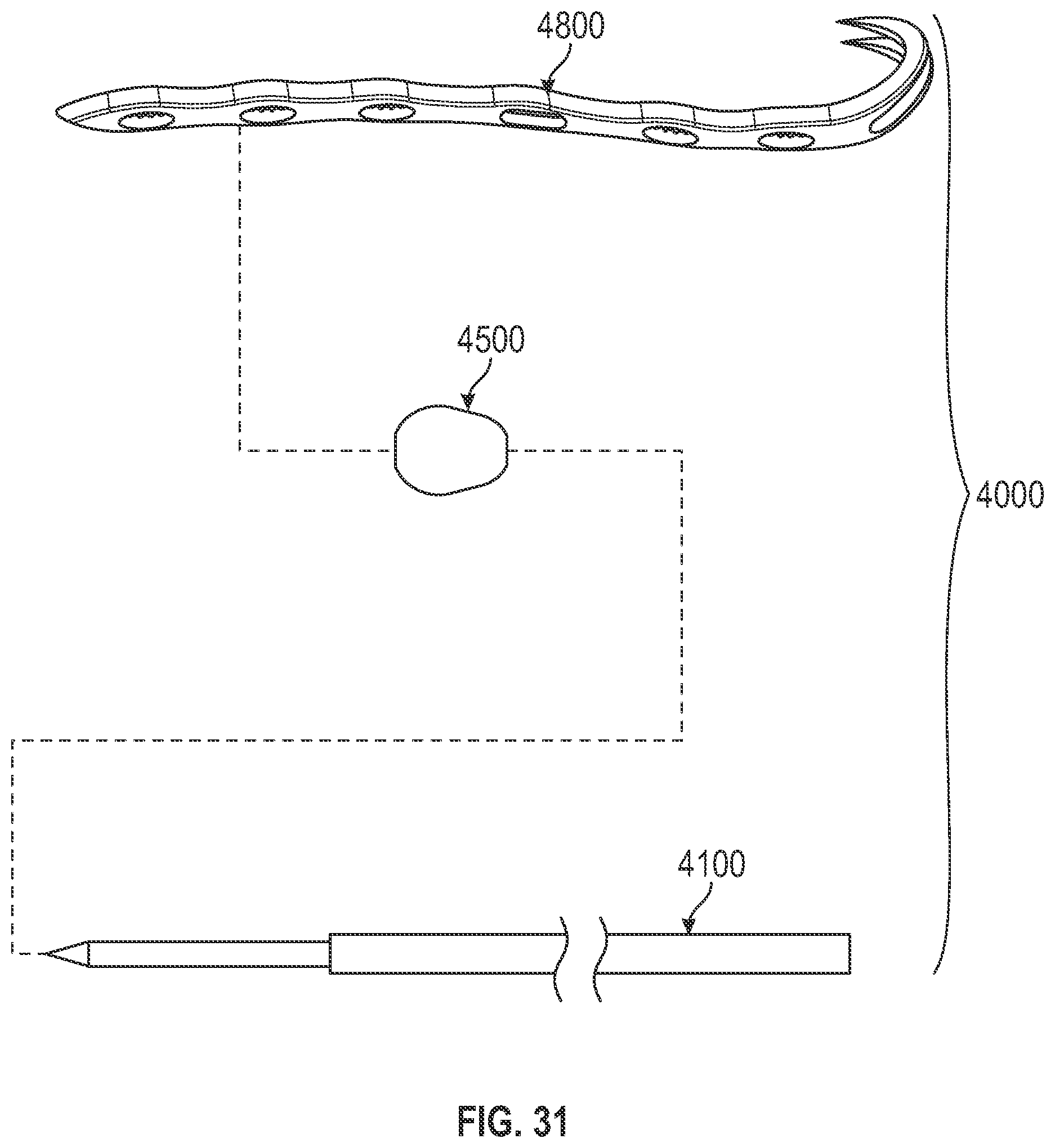 Patent US12310640 Figure 18 – Bone fixation devices, systems, kits, and methods