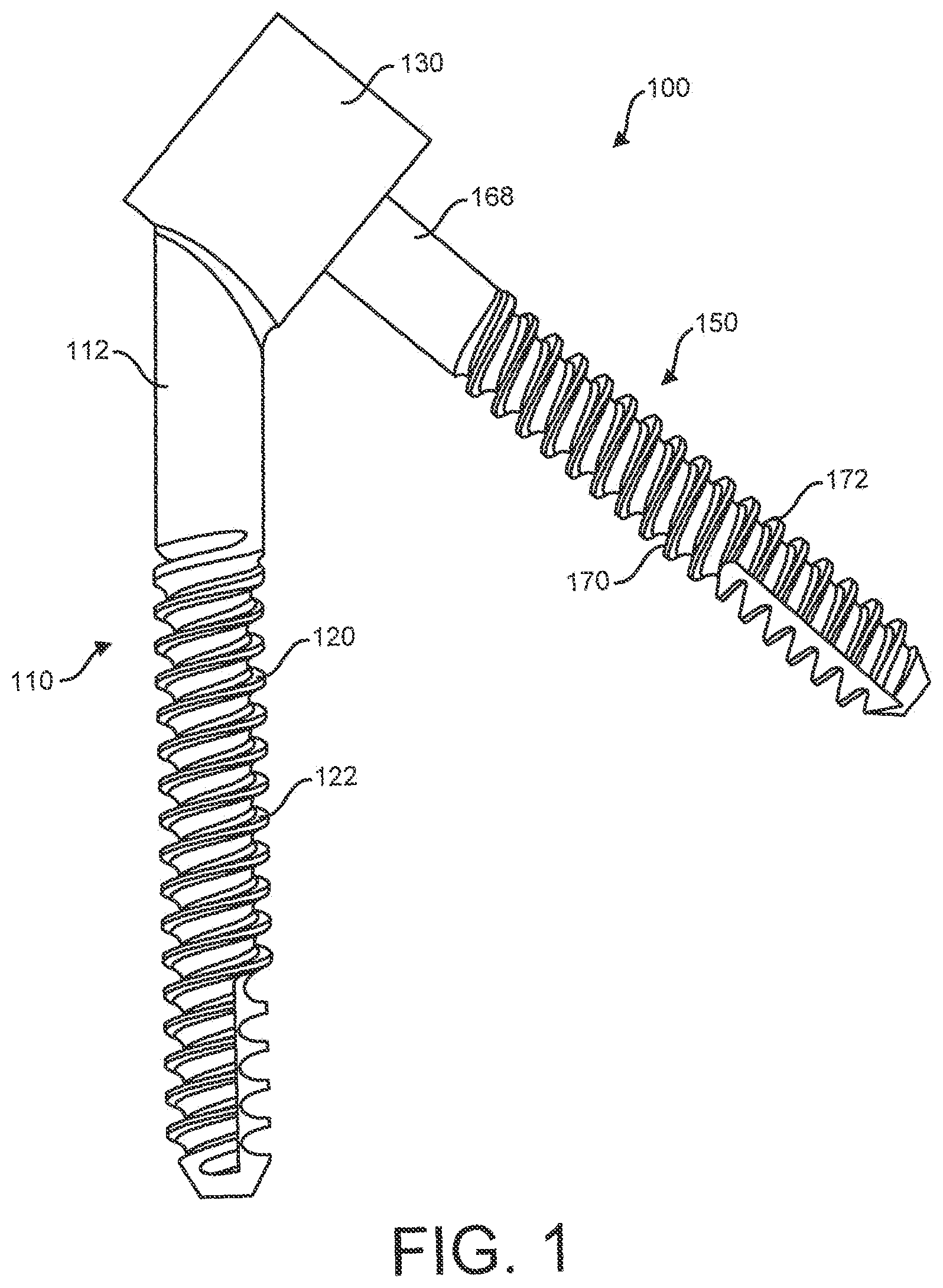 Patent US12310641 Figure 1 – Bone fixation system and methods of use