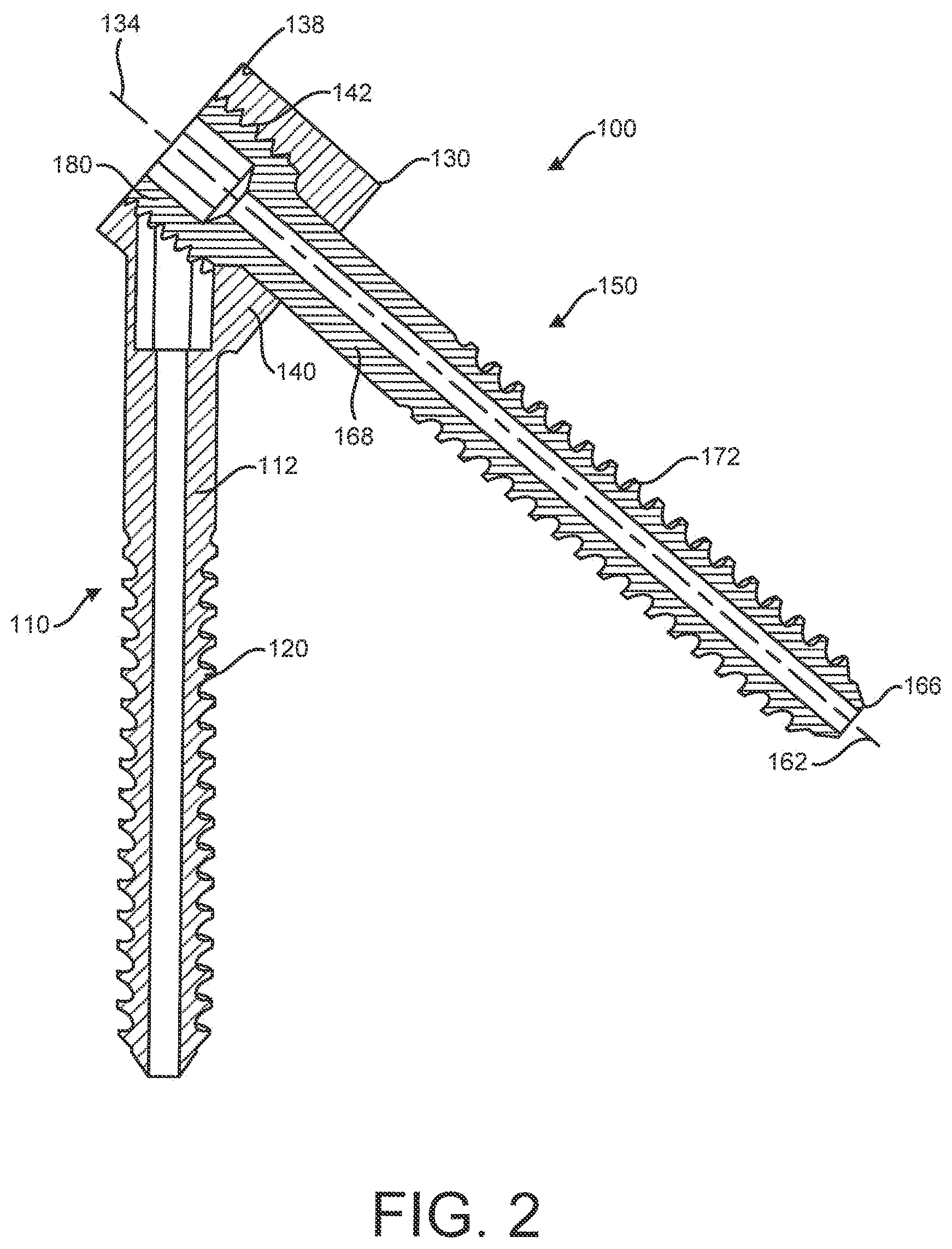 Patent US12310641 Figure 2 – Bone fixation system and methods of use