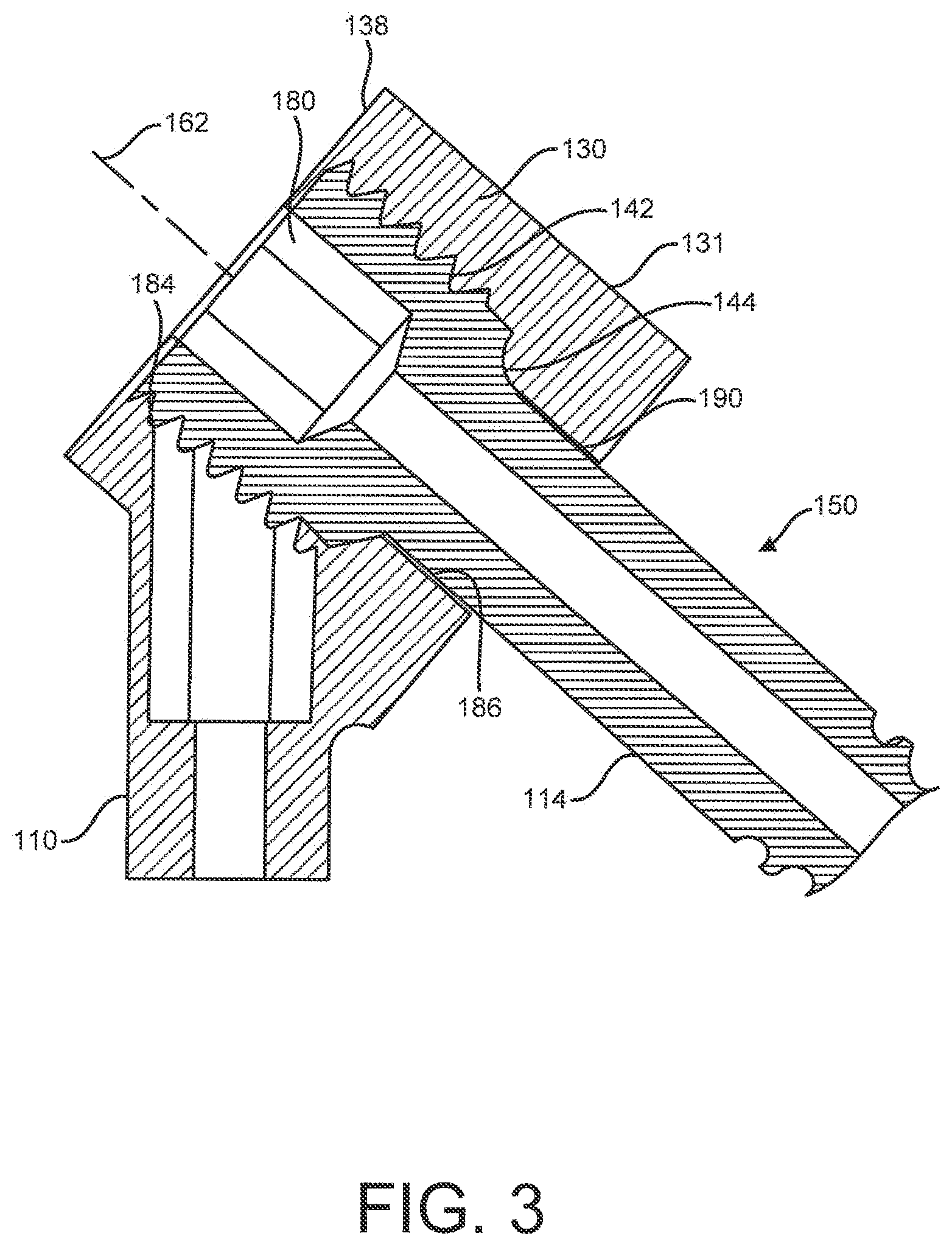 Patent US12310641 Figure 3 – Bone fixation system and methods of use