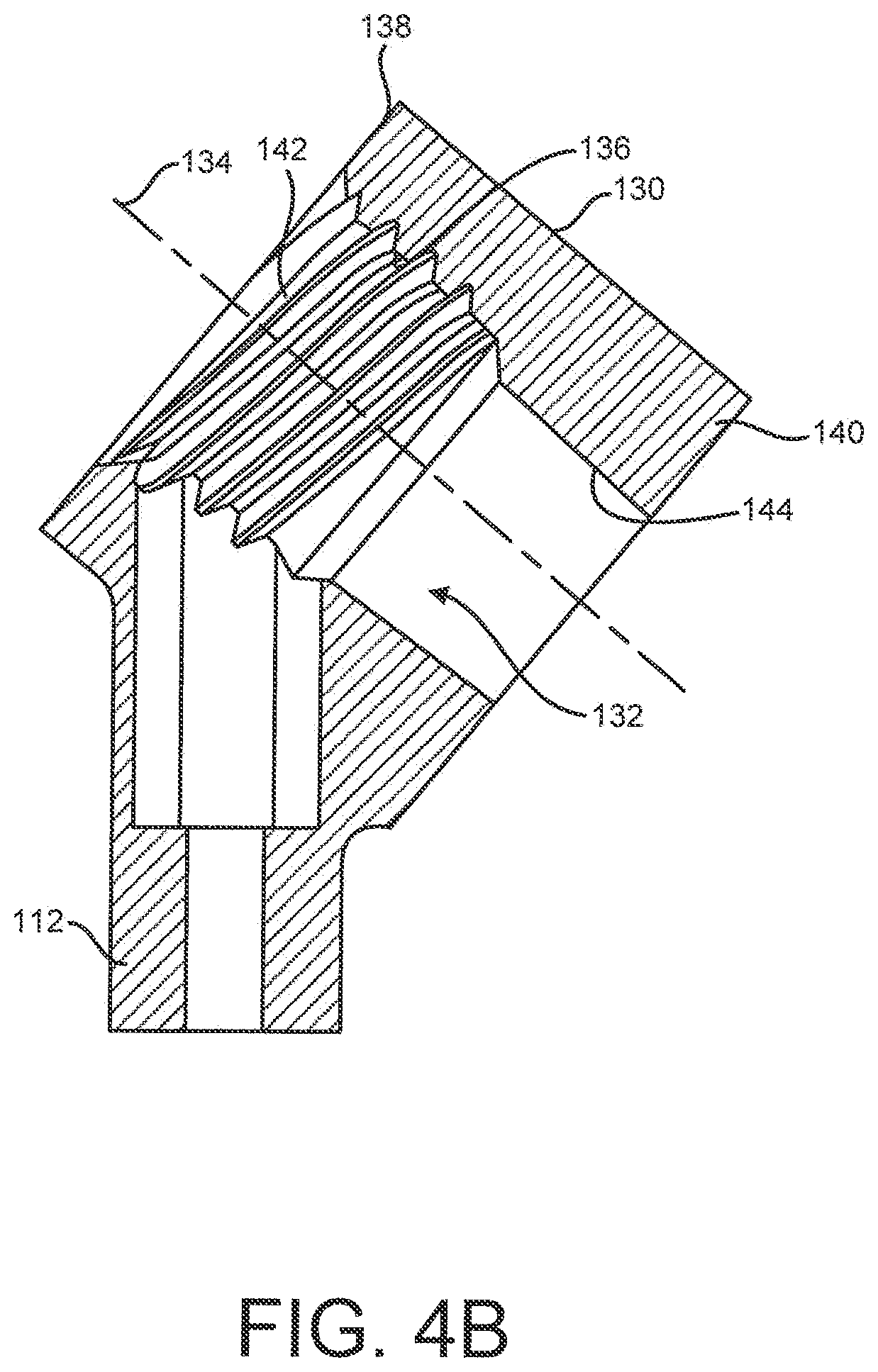 Patent US12310641 Figure 5 – Bone fixation system and methods of use