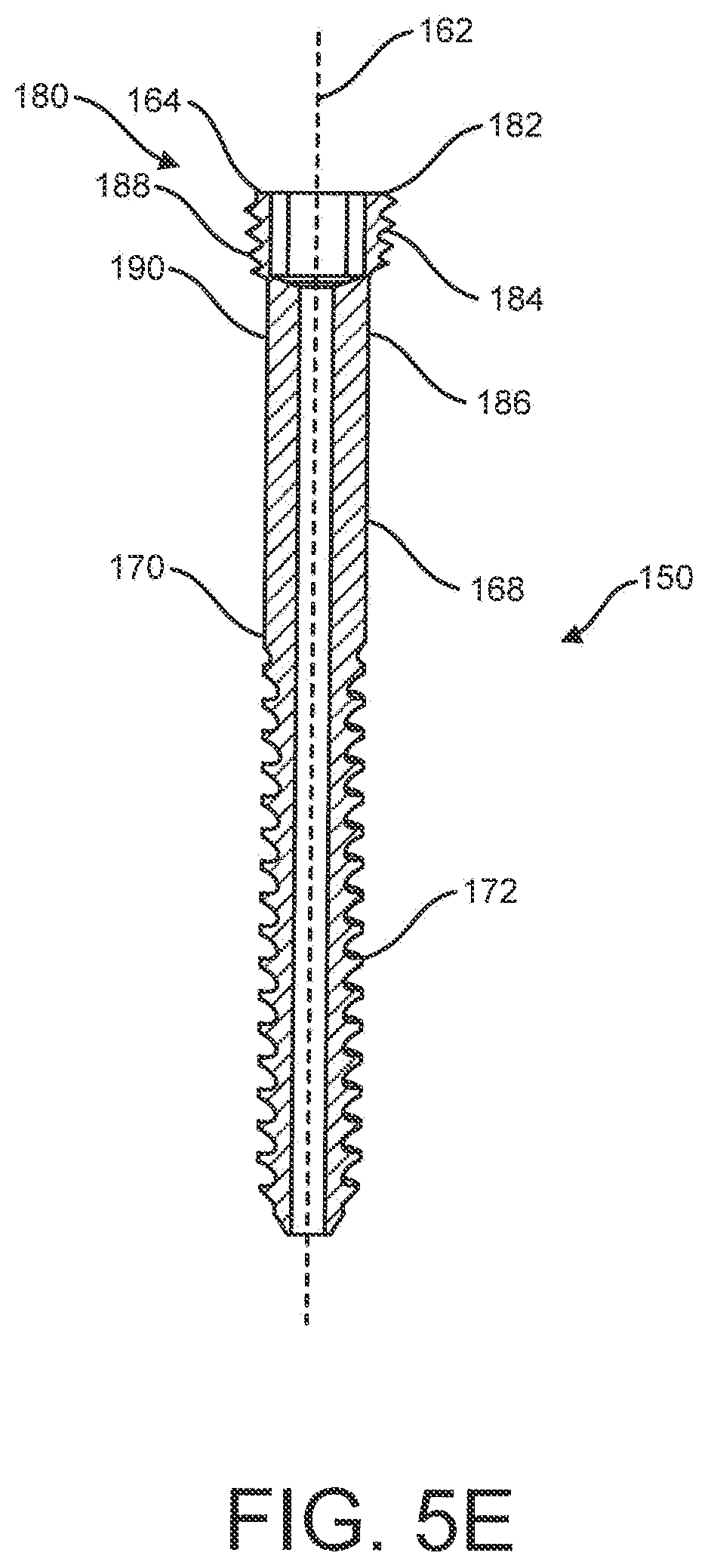 Patent US12310641 Figure 13 – Bone fixation system and methods of use