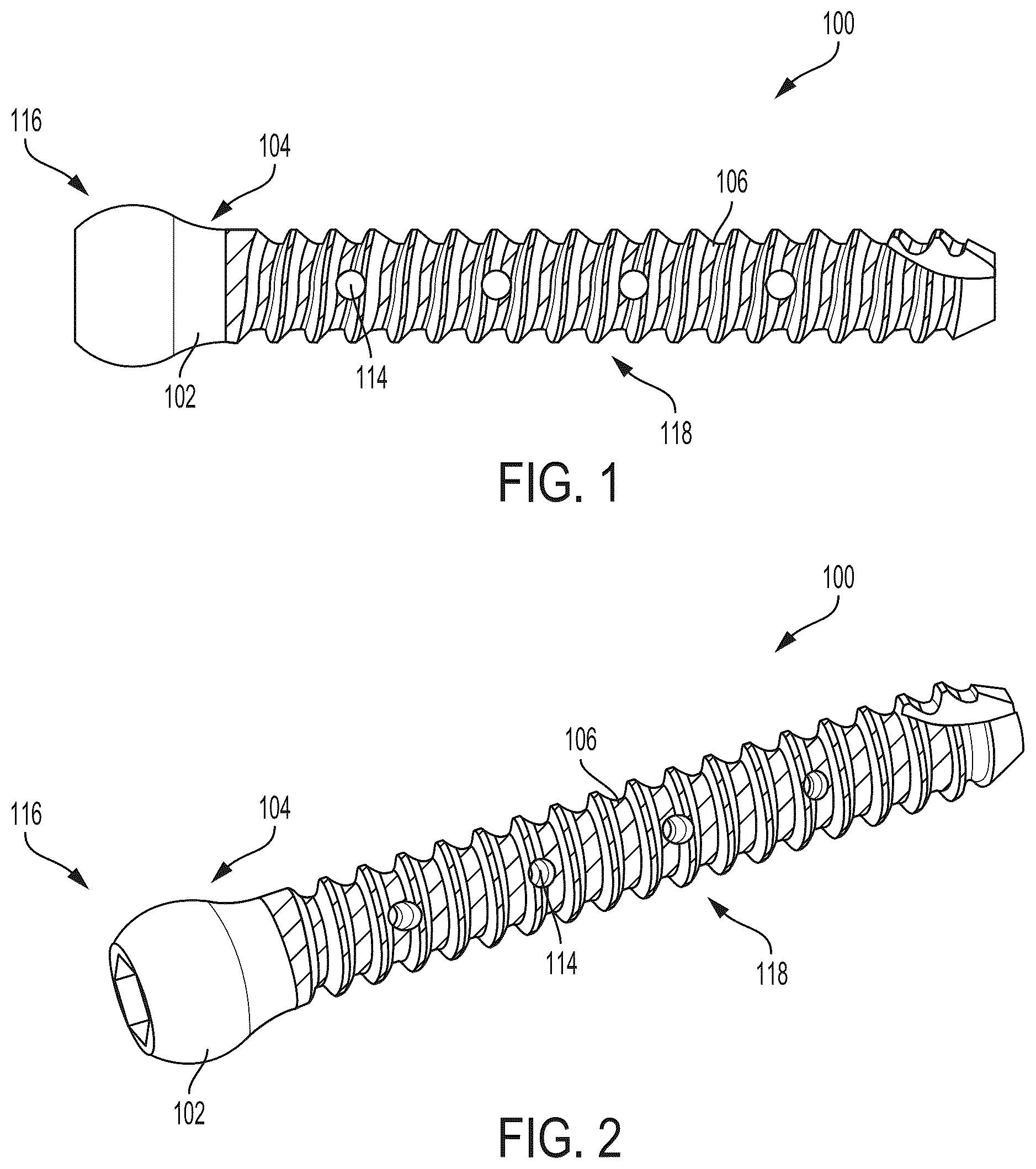 Patent US12310642 Figure 1 – Implant of osteostimulative material