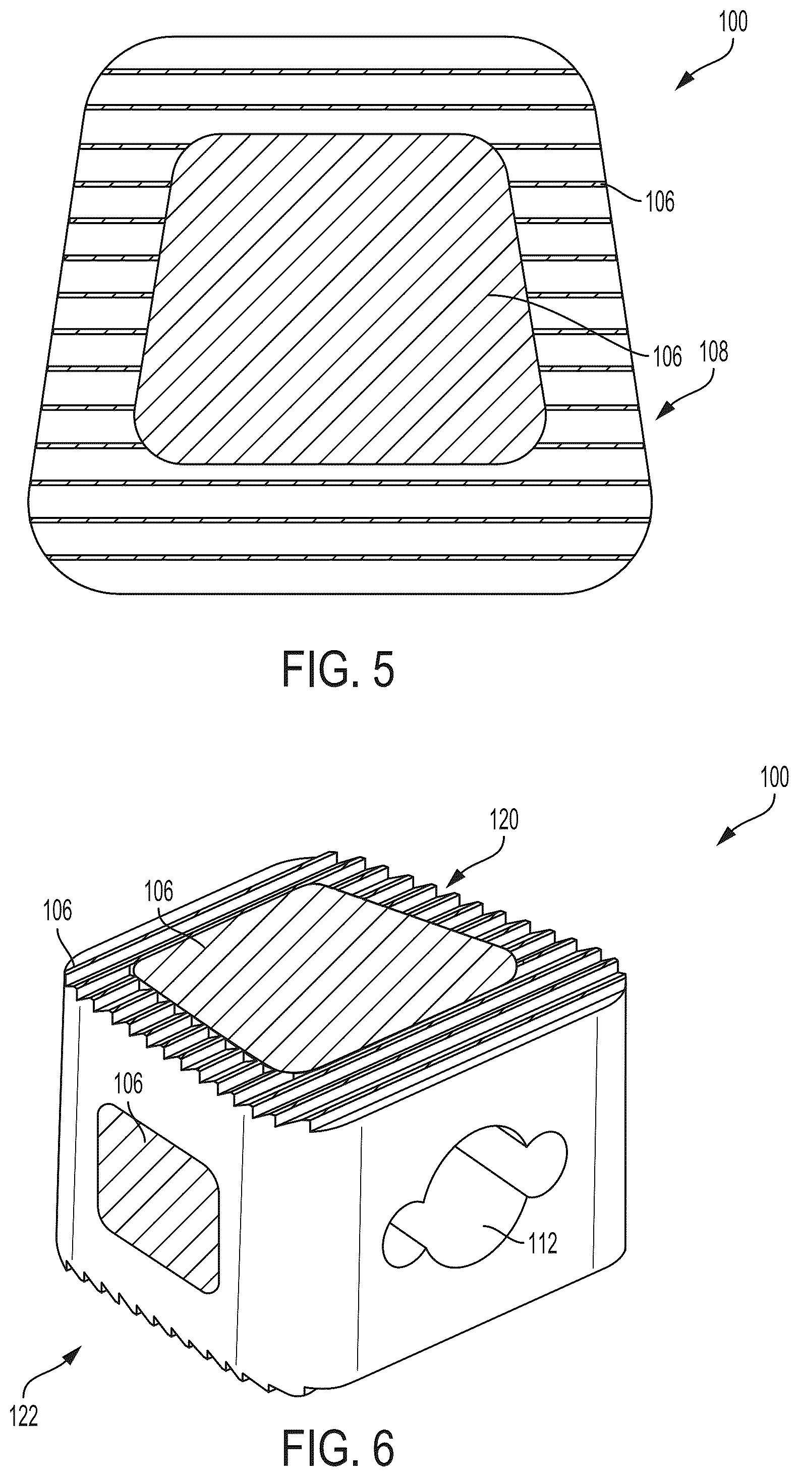 Patent US12310642 Figure 3 – Implant of osteostimulative material