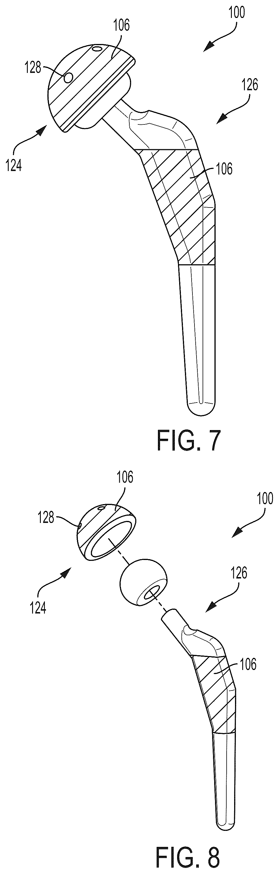 Patent US12310642 Figure 4 – Implant of osteostimulative material