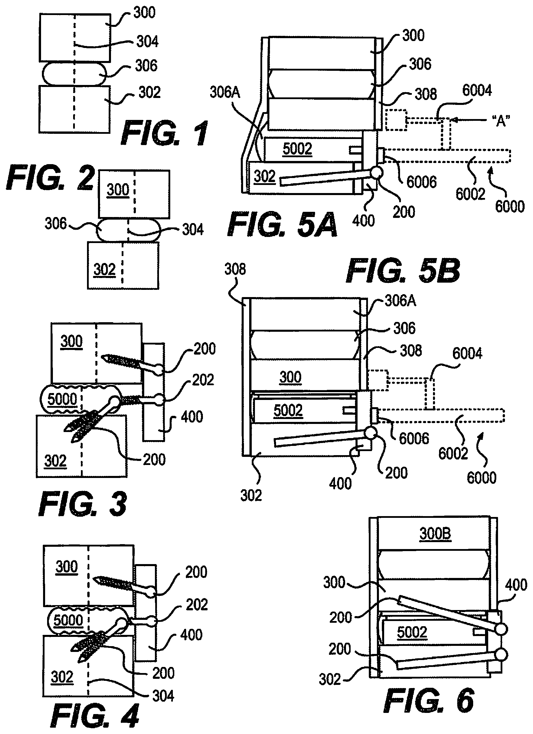 Patent US12310643 Figure 1 – Aligning vertebral bodies