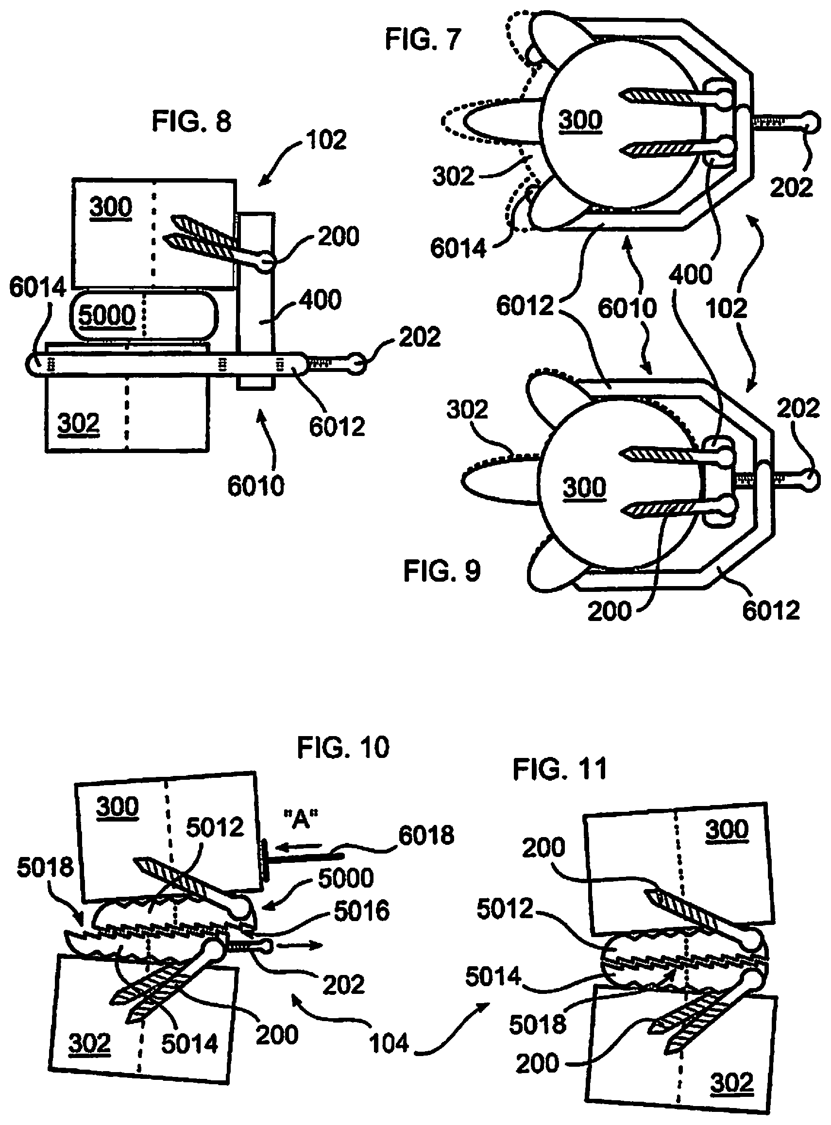 Patent US12310643 Figure 2 – Aligning vertebral bodies