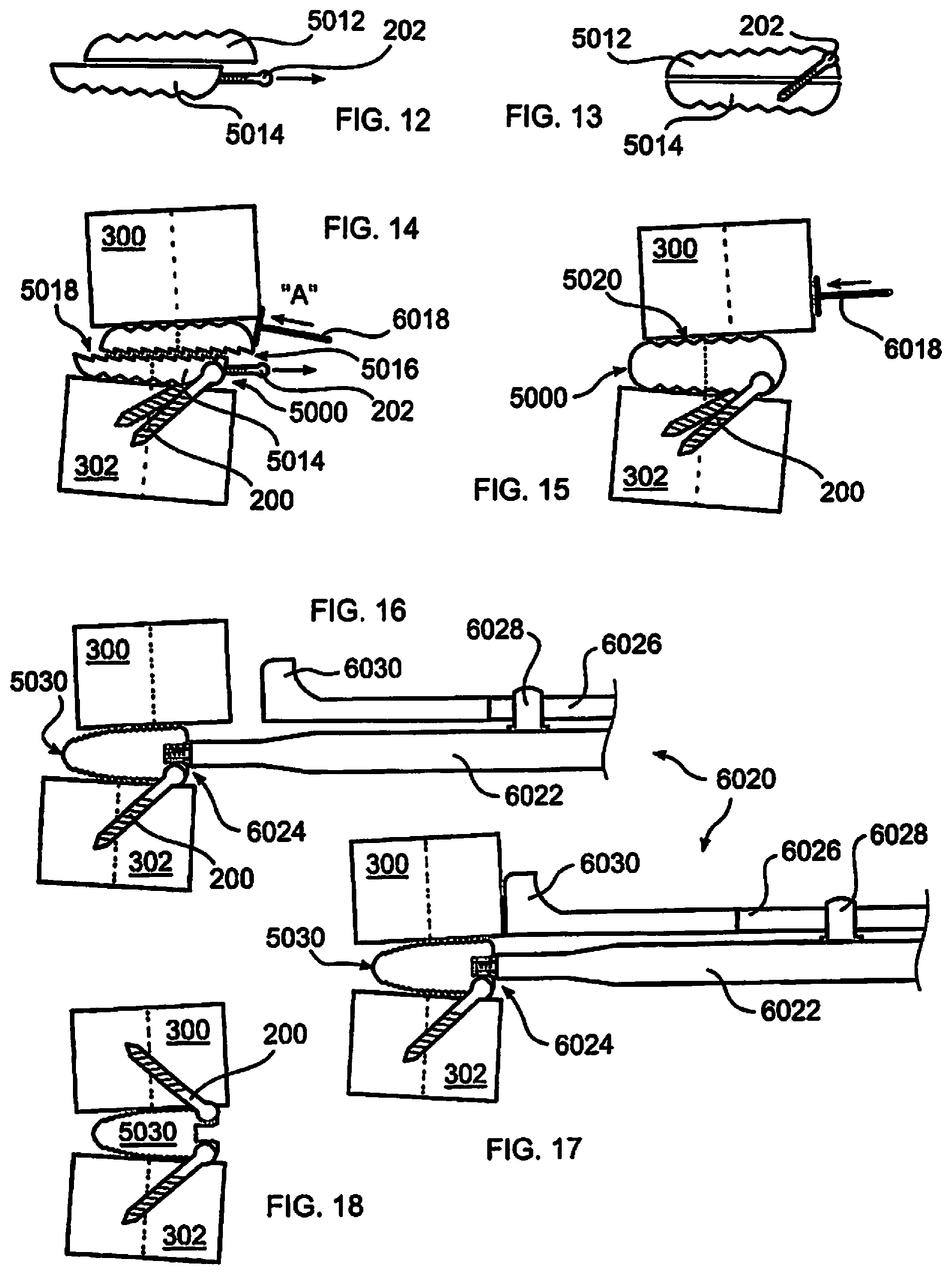 Patent US12310643 Figure 3 – Aligning vertebral bodies