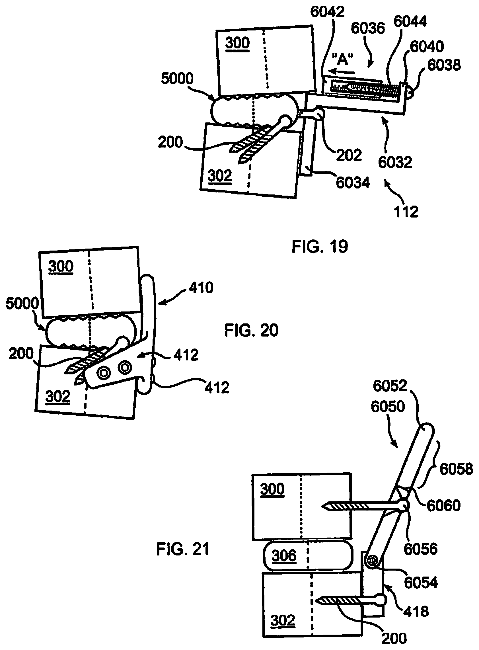 Patent US12310643 Figure 4 – Aligning vertebral bodies