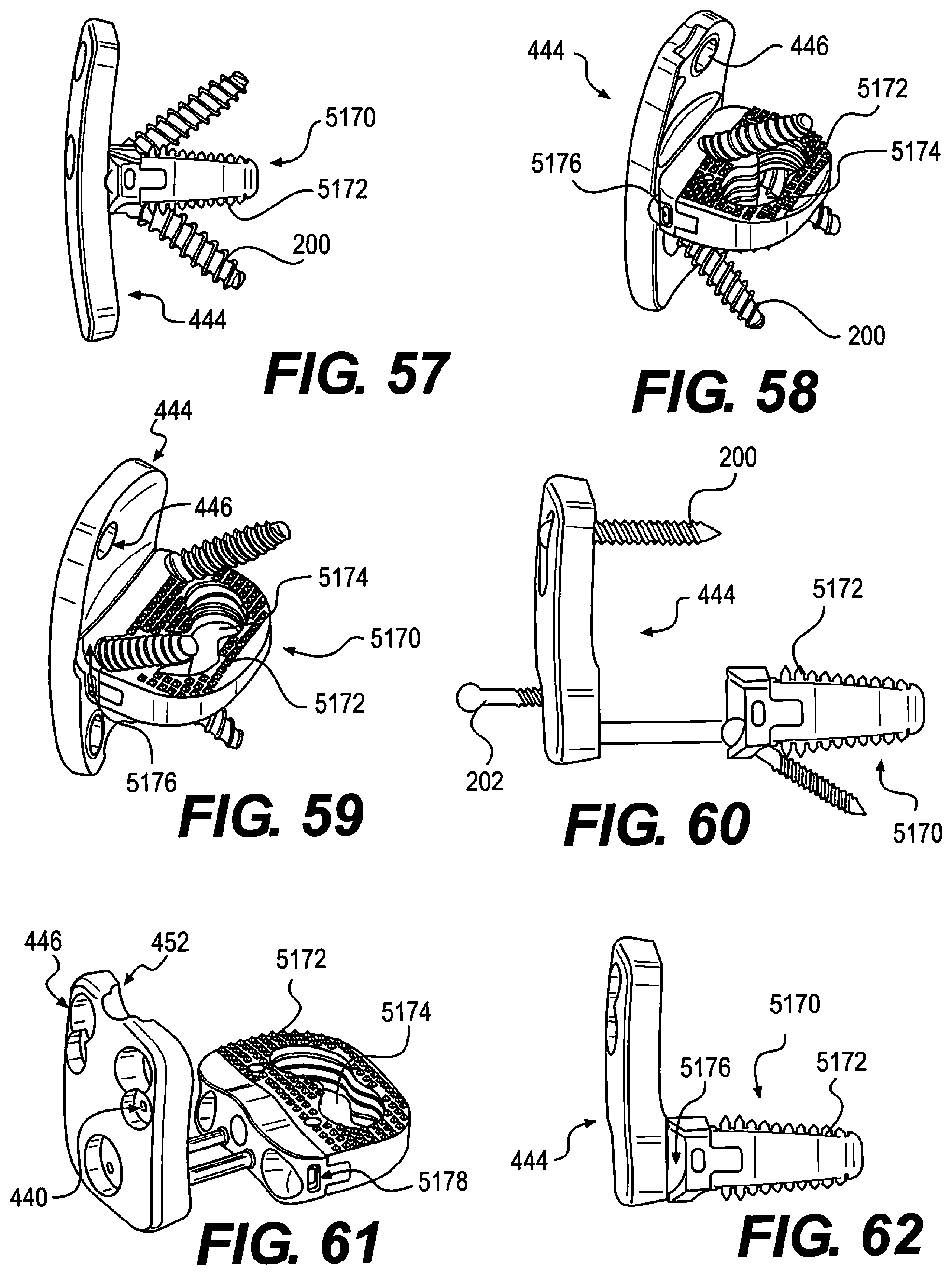 Patent US12310643 Figure 11 – Aligning vertebral bodies