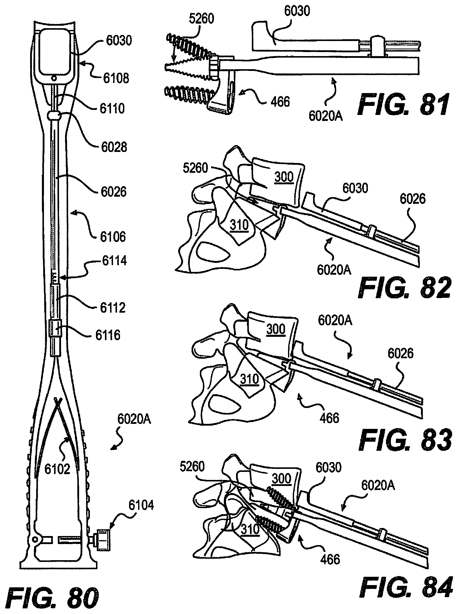 Patent US12310643 Figure 15 – Aligning vertebral bodies