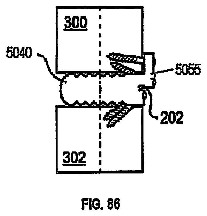 Patent US12310643 Figure 17 – Aligning vertebral bodies