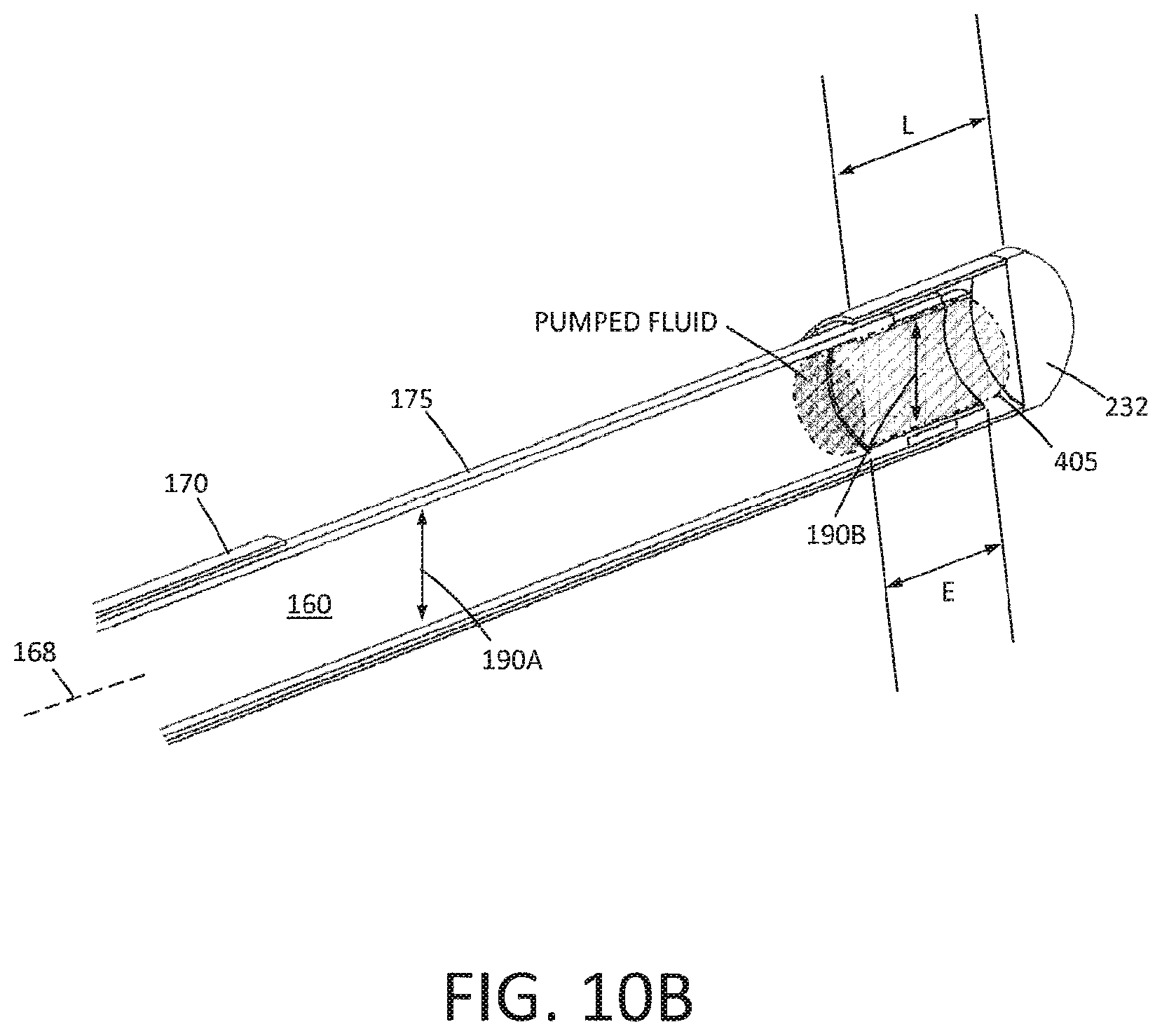 Patent US12310649 Figure 10 – Tissue extraction devices and methods