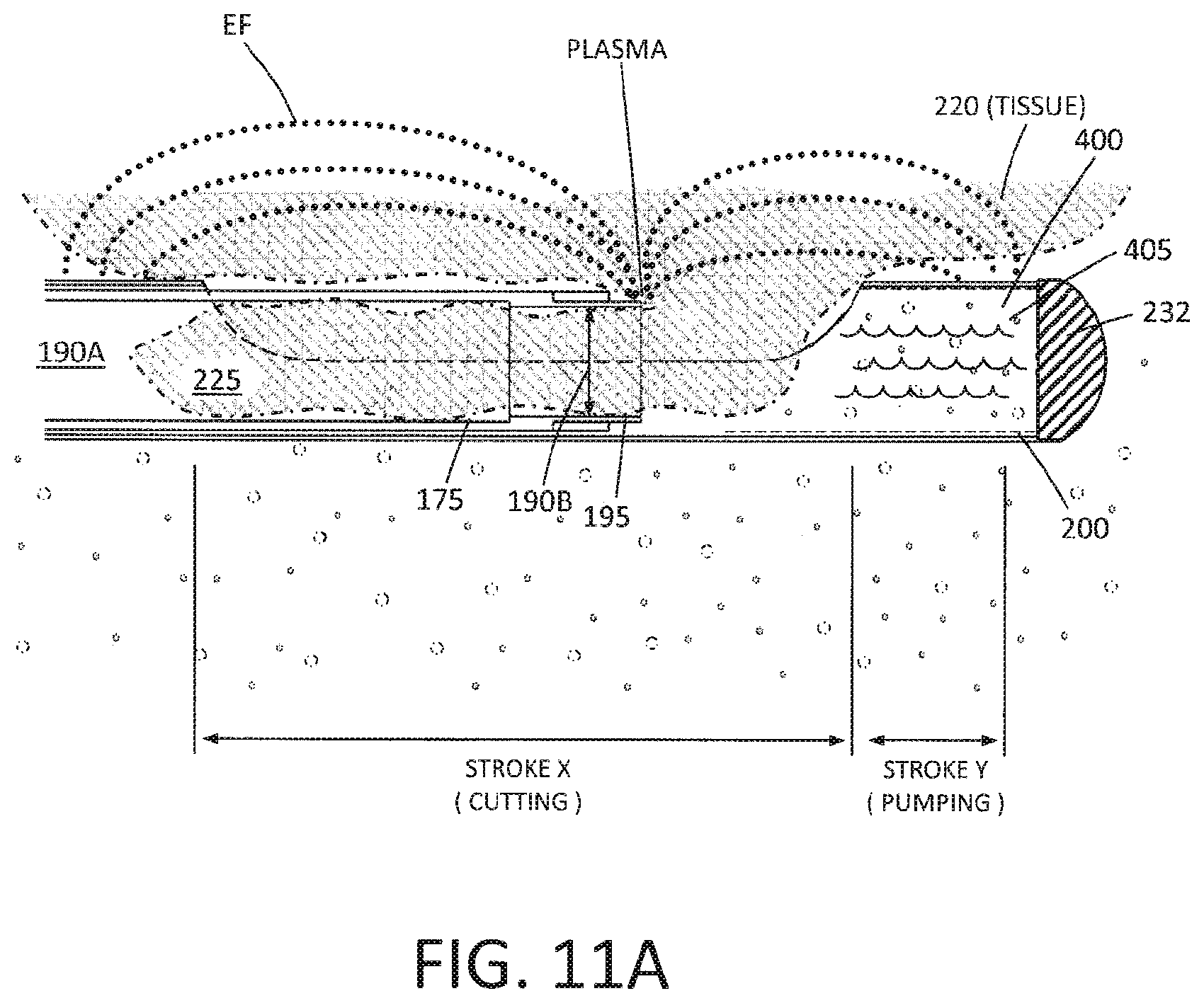 Patent US12310649 Figure 11 – Tissue extraction devices and methods