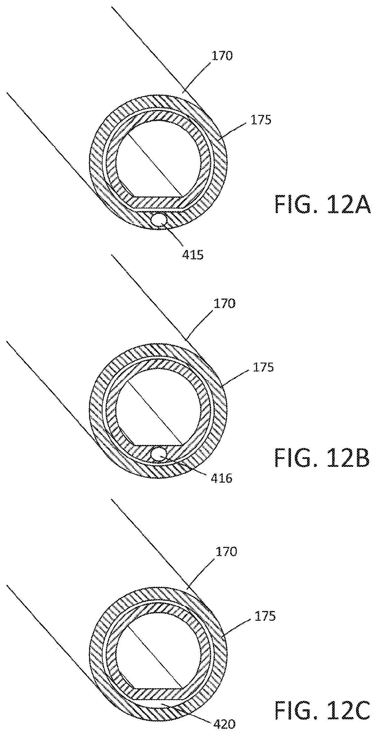 Patent US12310649 Figure 13 – Tissue extraction devices and methods
