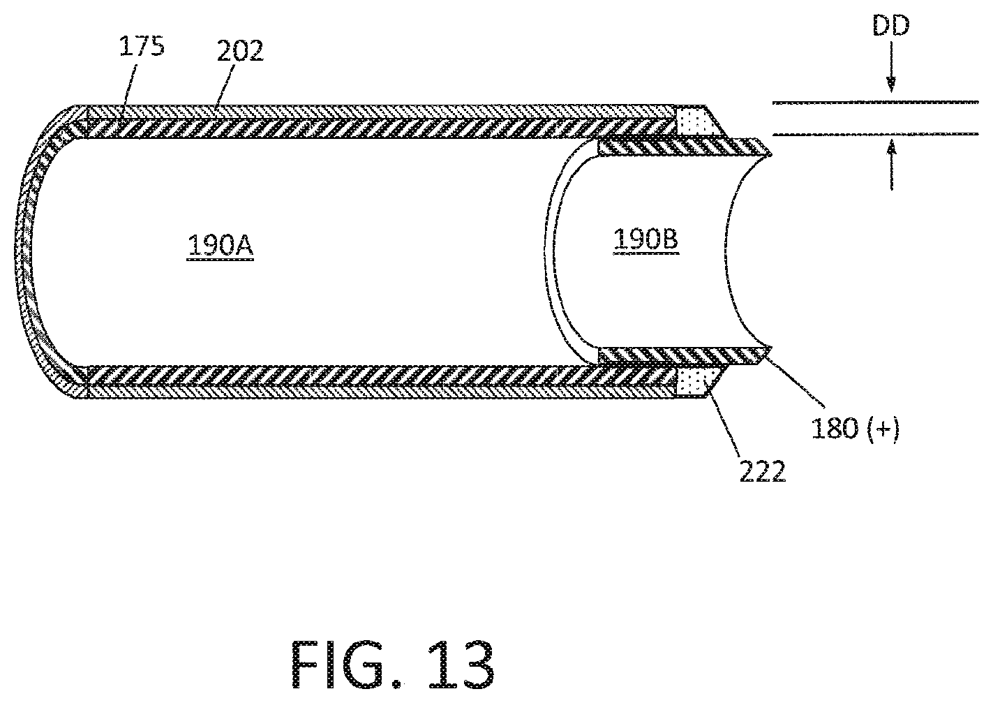 Patent US12310649 Figure 14 – Tissue extraction devices and methods