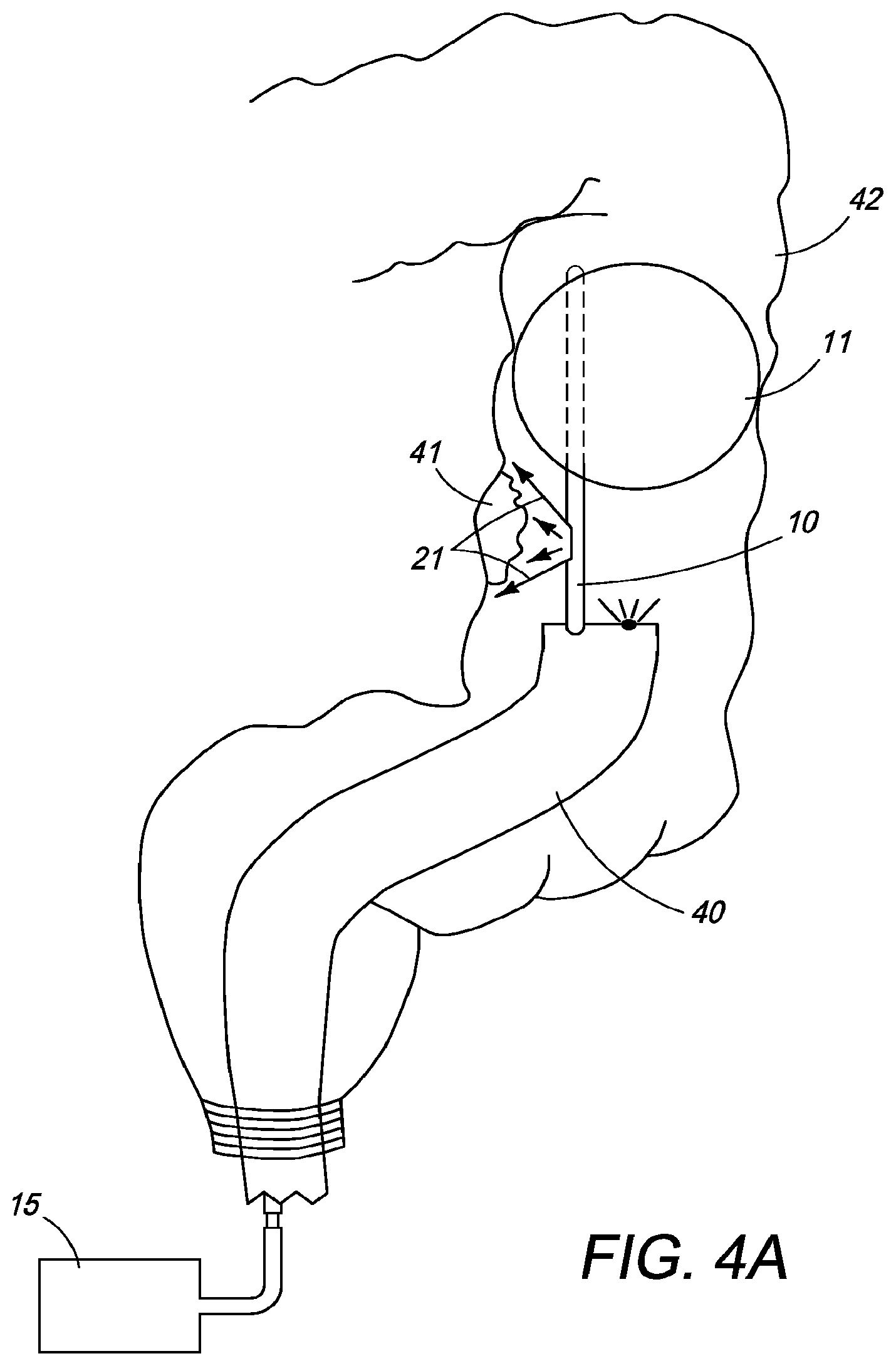 Patent US12310650 Figure 7 – Methods of ablating tissue using time-limited treatment periods