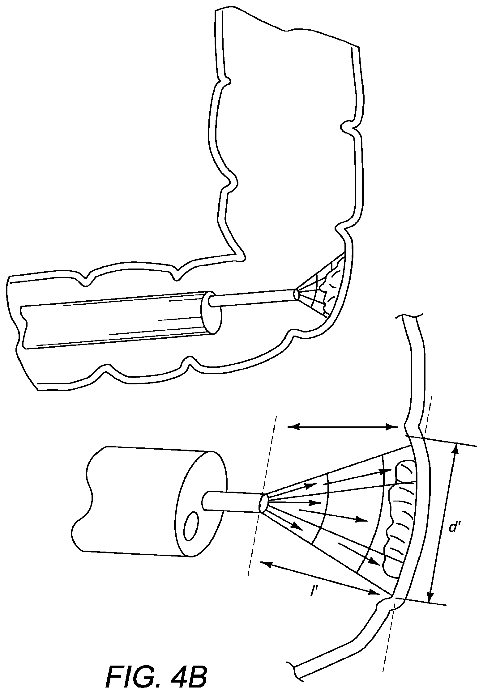 Patent US12310650 Figure 8 – Methods of ablating tissue using time-limited treatment periods