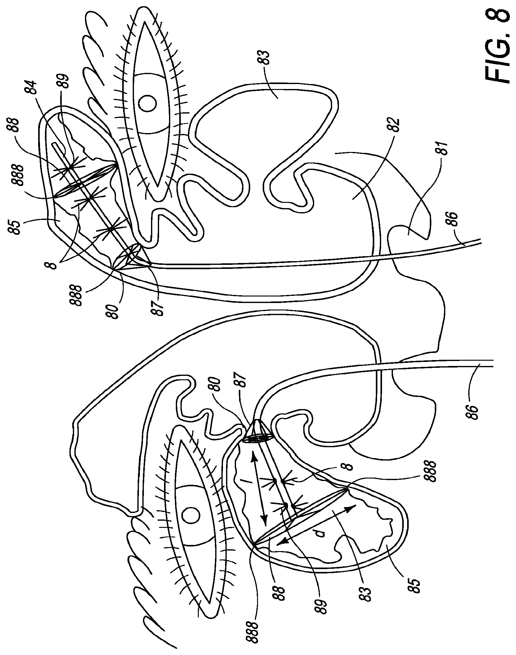 Patent US12310650 Figure 12 – Methods of ablating tissue using time-limited treatment periods