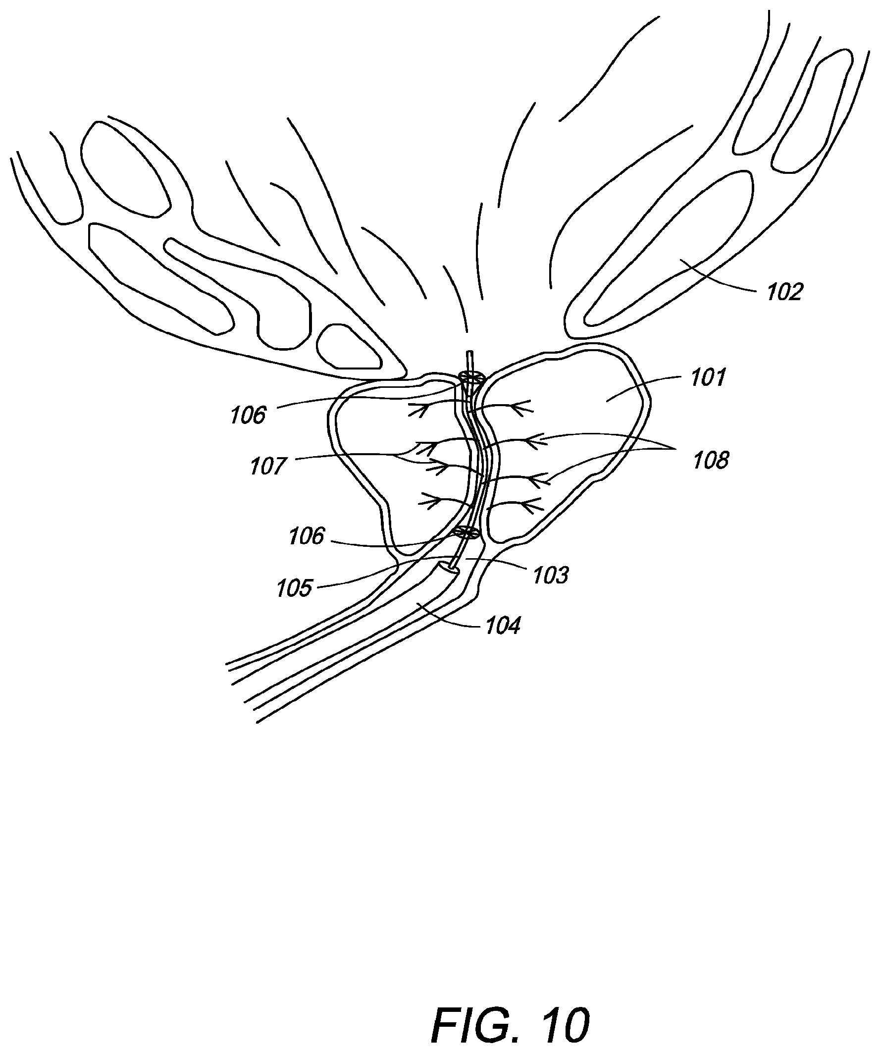 Patent US12310650 Figure 14 – Methods of ablating tissue using time-limited treatment periods