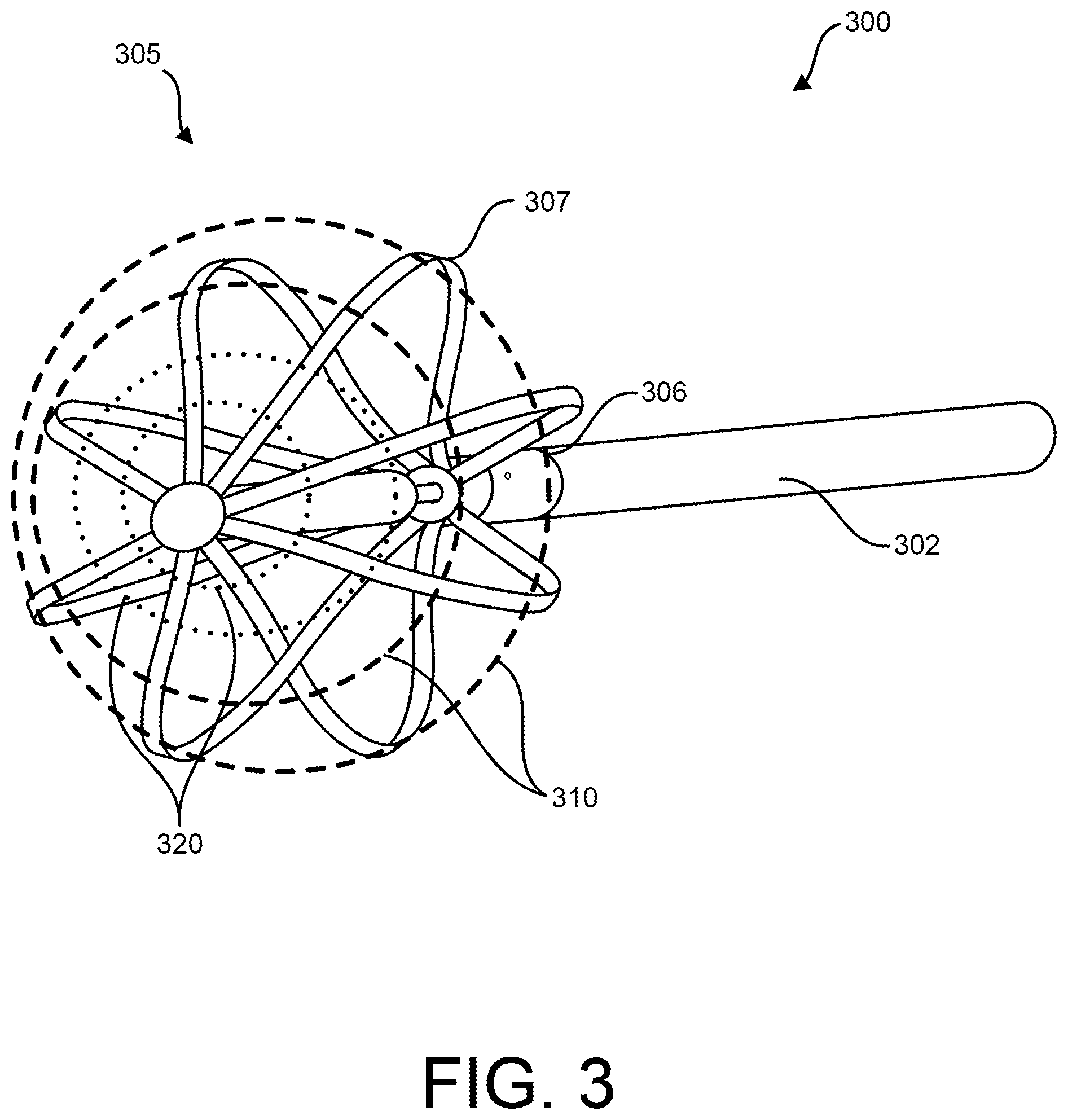 Patent US12310652 Figure 5 – Hybrid electroporation ablation catheter