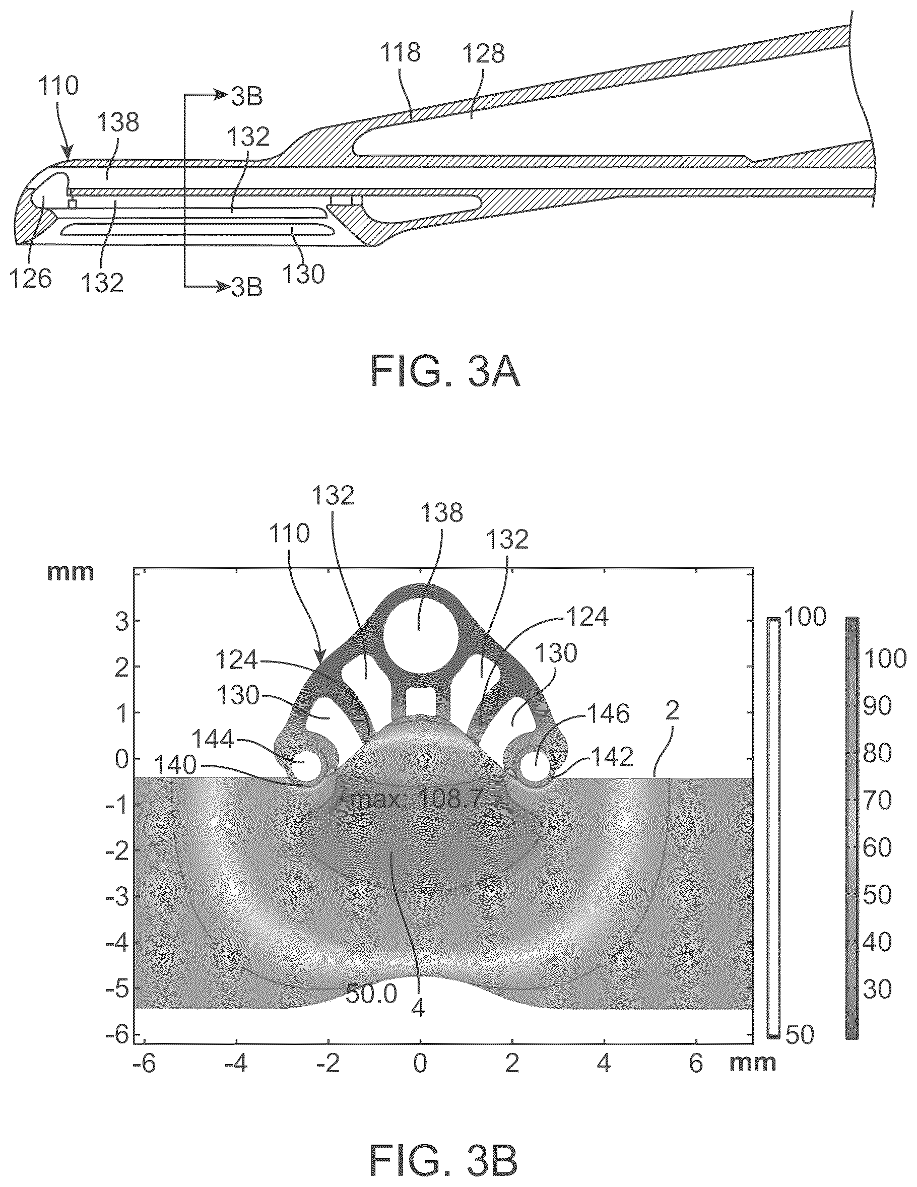 Patent US12310654 Figure 3 – RF ablation device
