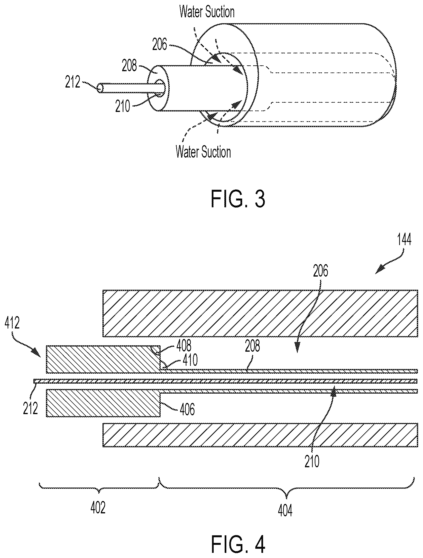 Patent US12310657 Figure 4 – Equipment for crushing urinary stone