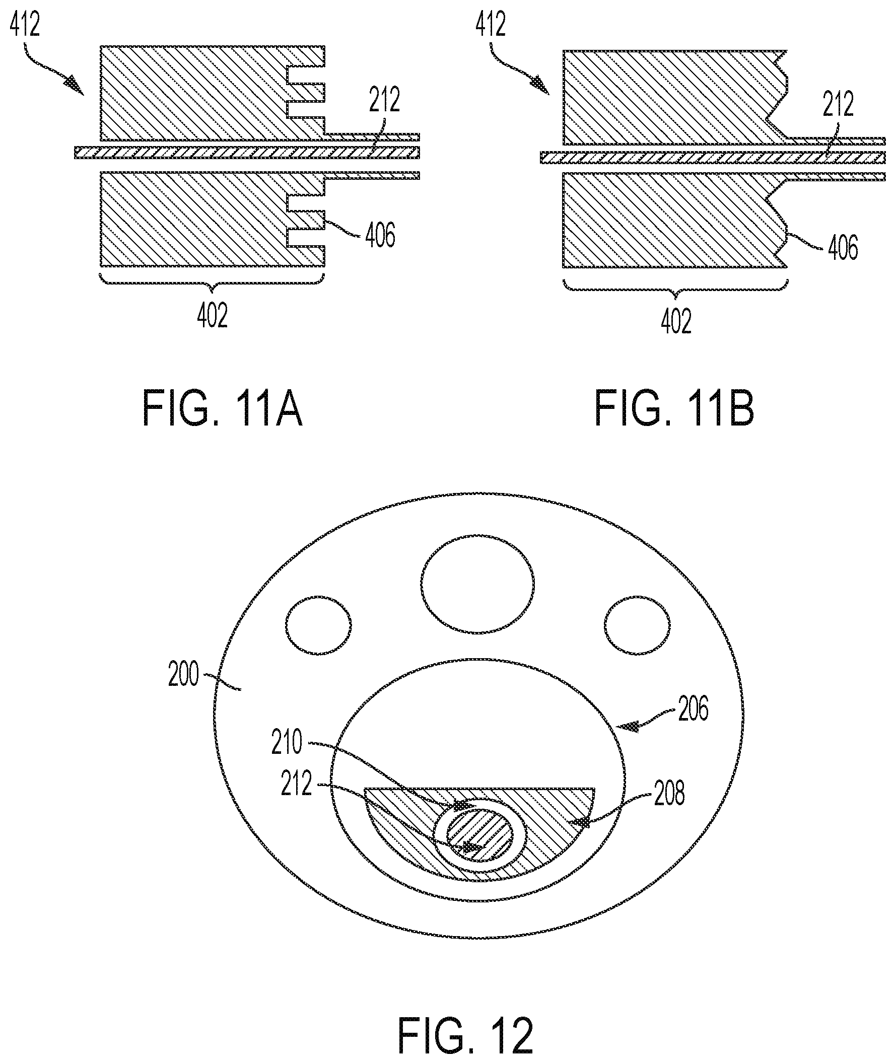 Patent US12310657 Figure 8 – Equipment for crushing urinary stone