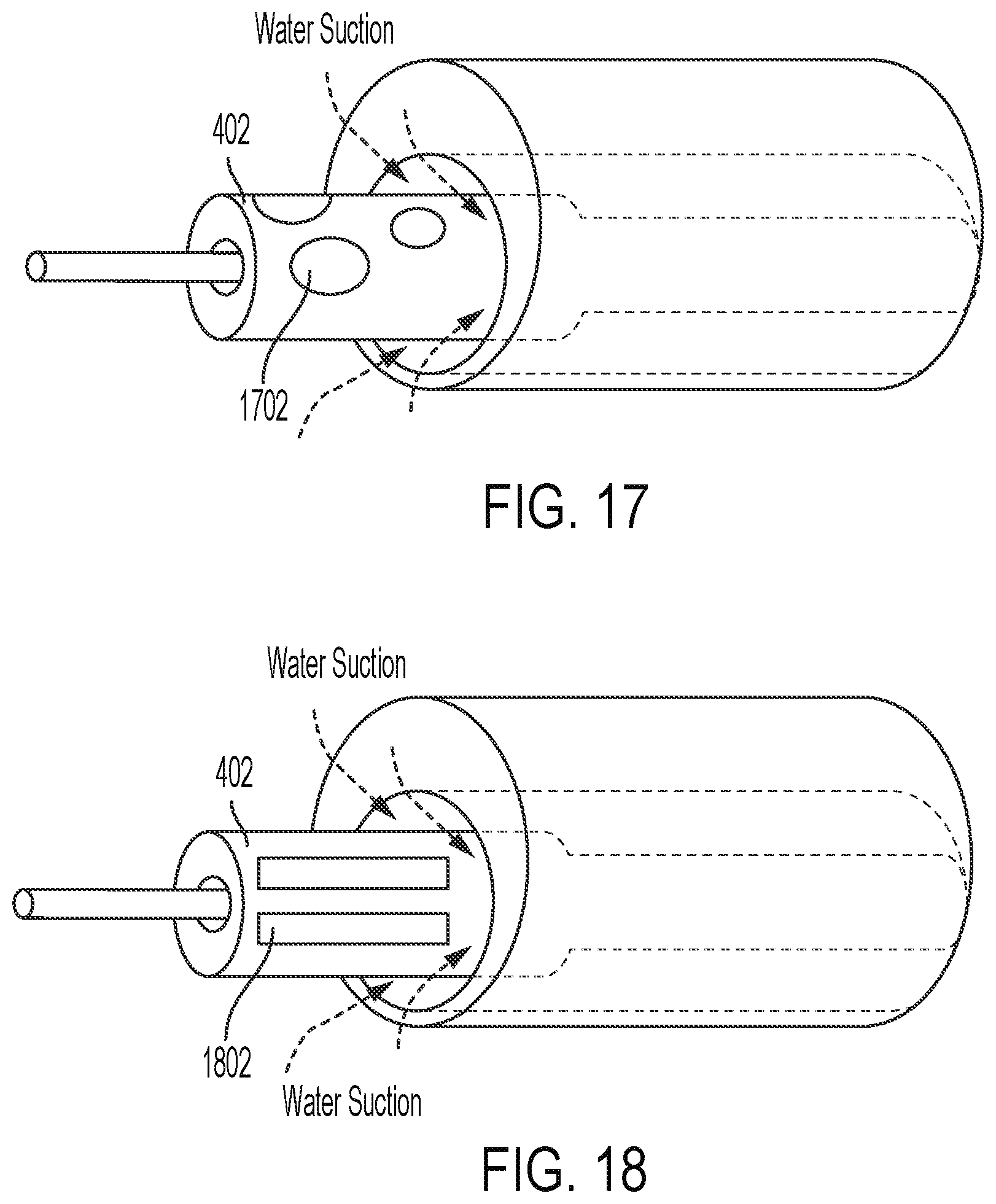 Patent US12310657 Figure 11 – Equipment for crushing urinary stone