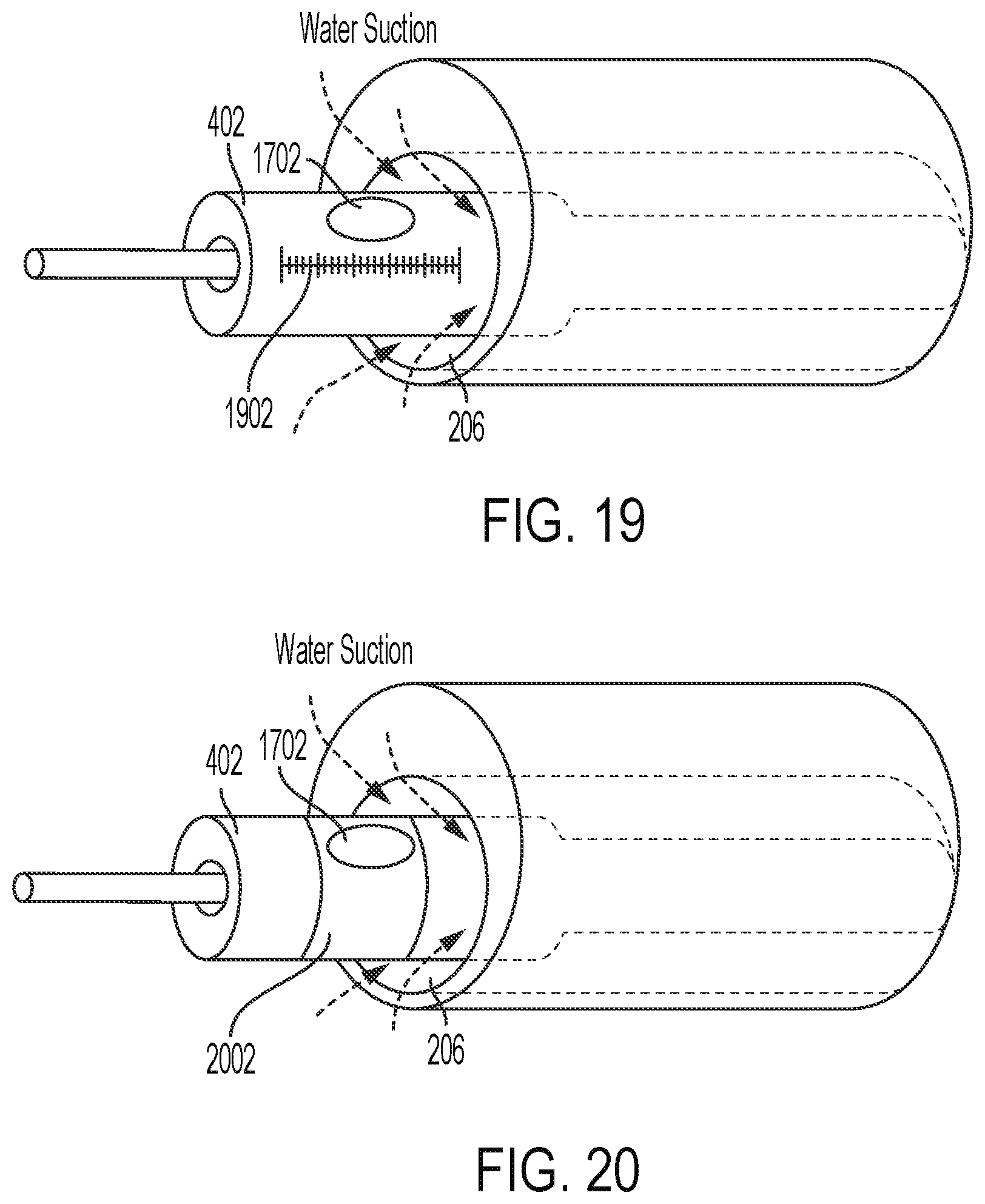 Patent US12310657 Figure 12 – Equipment for crushing urinary stone