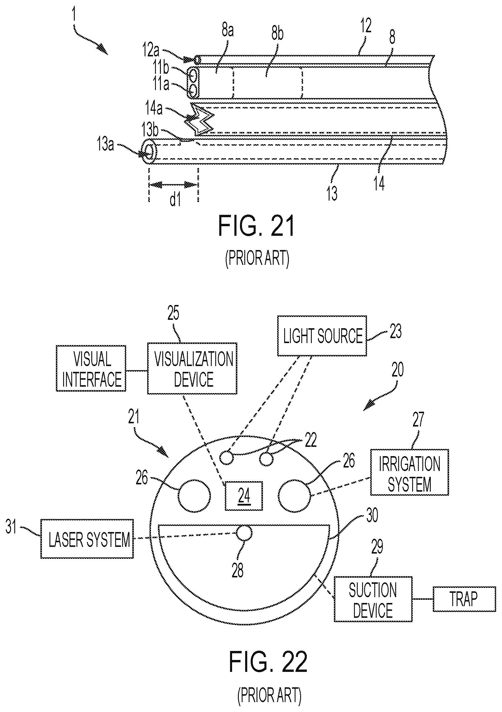 Patent US12310657 Figure 13 – Equipment for crushing urinary stone