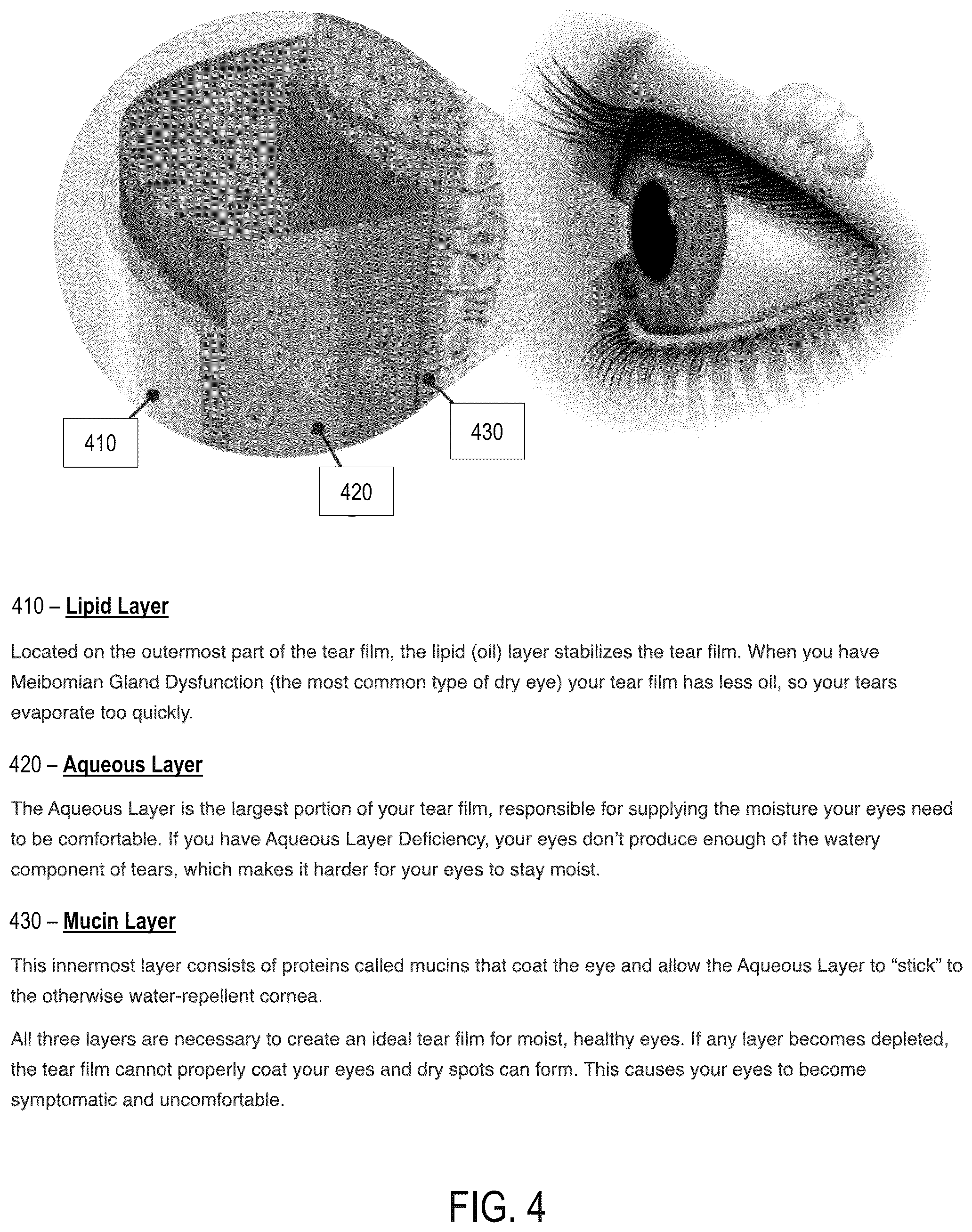 Patent US12310660 Figure 7 – Ocular hydration sensor