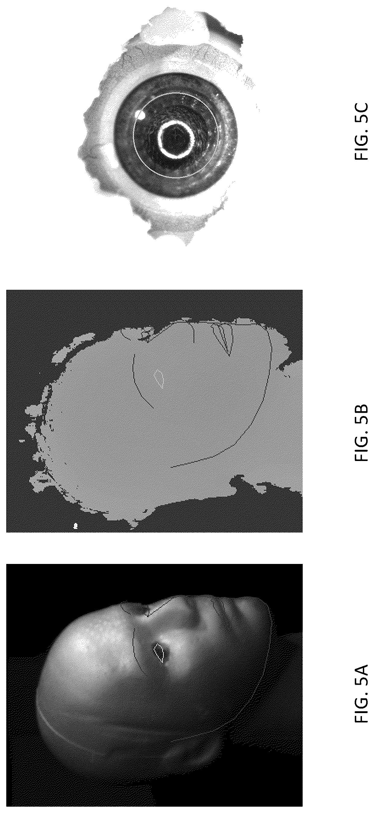 Patent US12310661 Figure 5 – Systems and methods for imaging a target feature of a subject based on tracked positions of the subject and the target feature