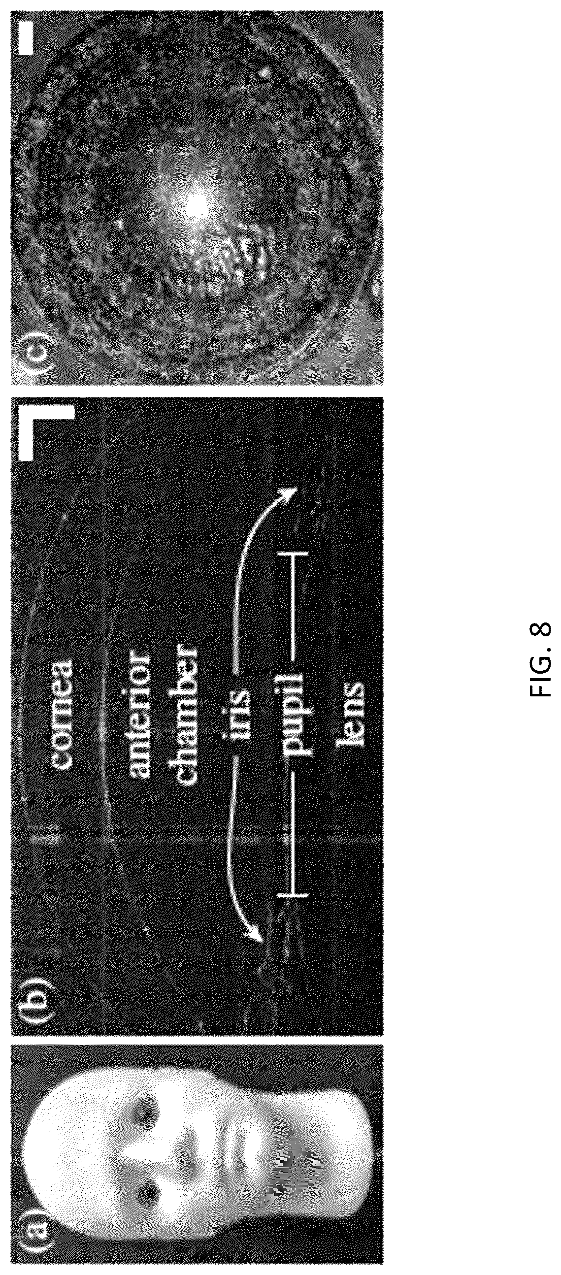 Patent US12310661 Figure 8 – Systems and methods for imaging a target feature of a subject based on tracked positions of the subject and the target feature