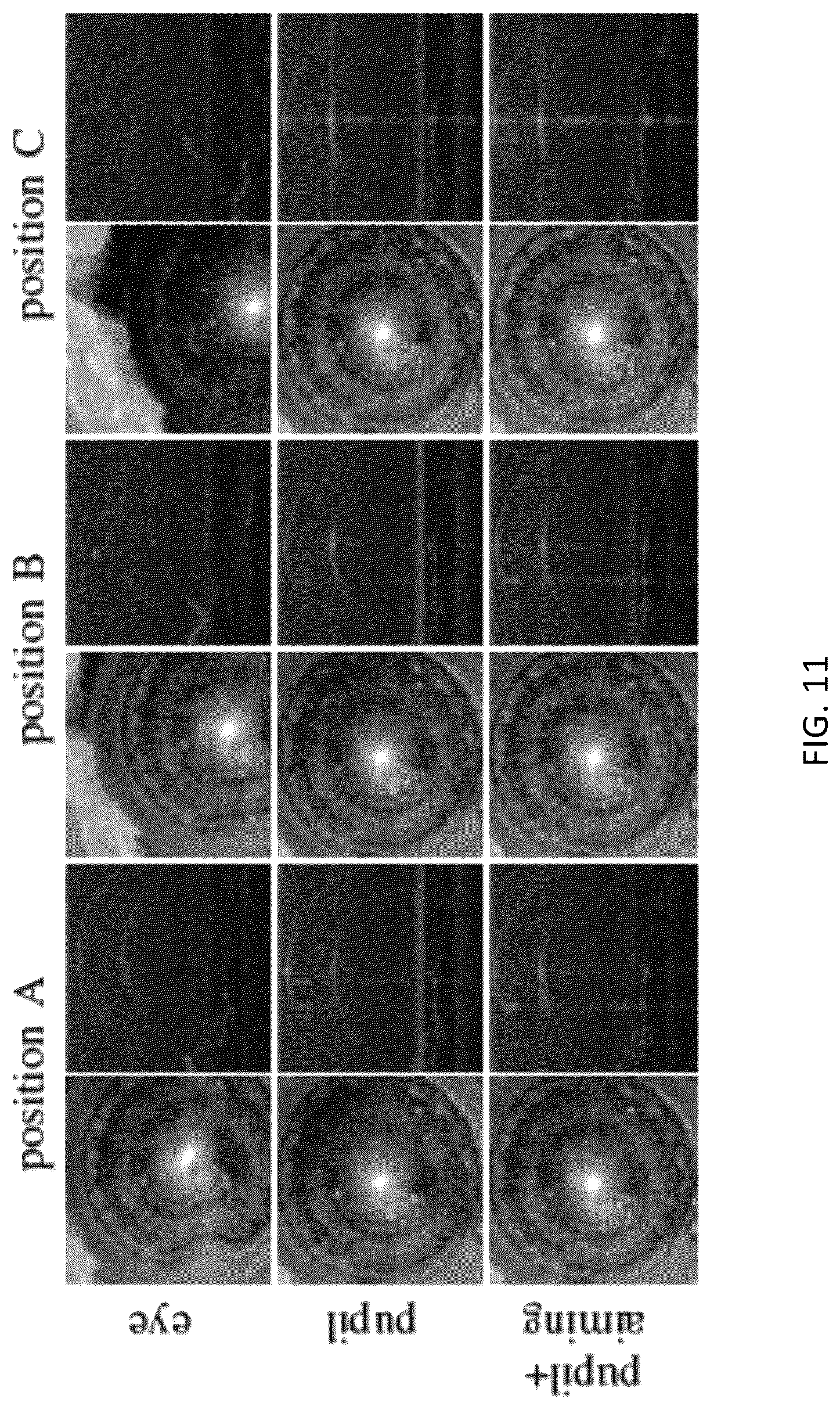 Patent US12310661 Figure 11 – Systems and methods for imaging a target feature of a subject based on tracked positions of the subject and the target feature