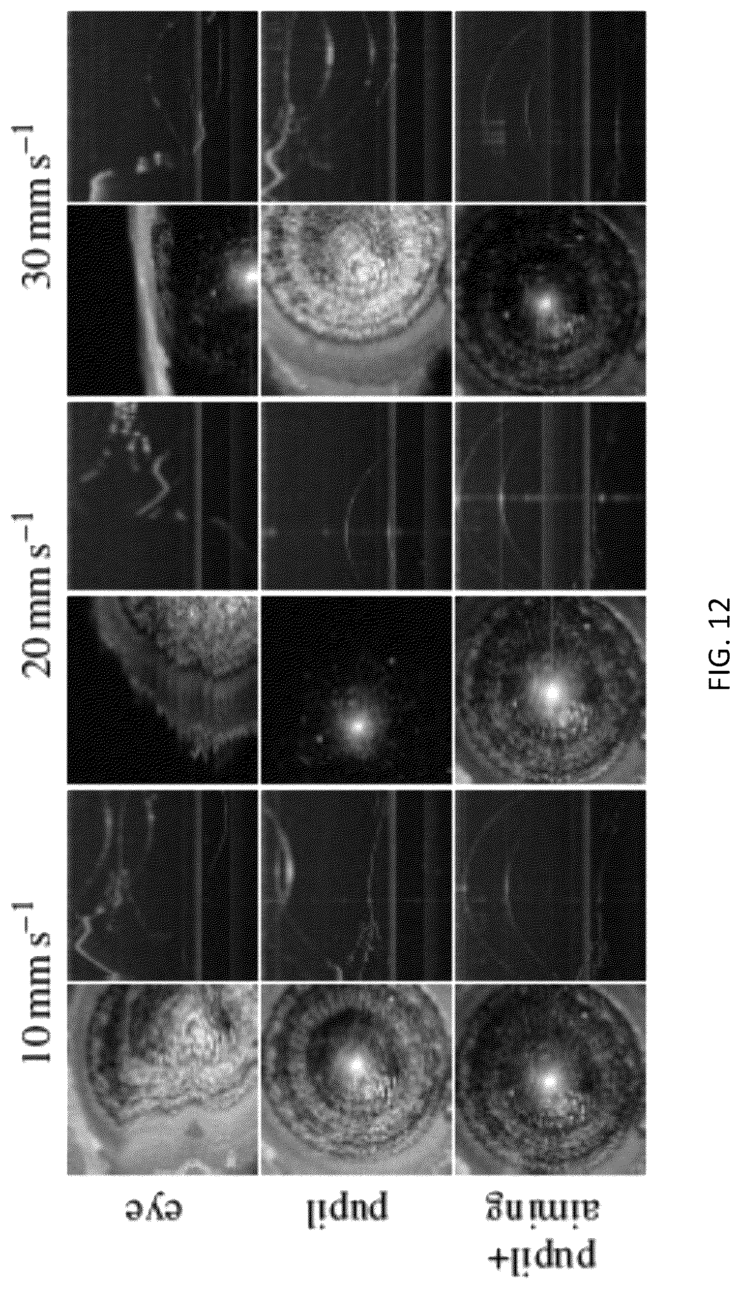Patent US12310661 Figure 12 – Systems and methods for imaging a target feature of a subject based on tracked positions of the subject and the target feature