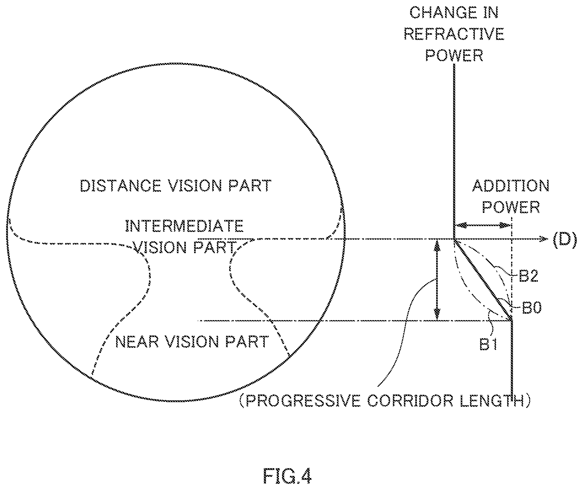 Patent US12310662 Figure 4 – Measuring method for measuring rotation characteristic of eyeball of subject and setting method for progressive power lens