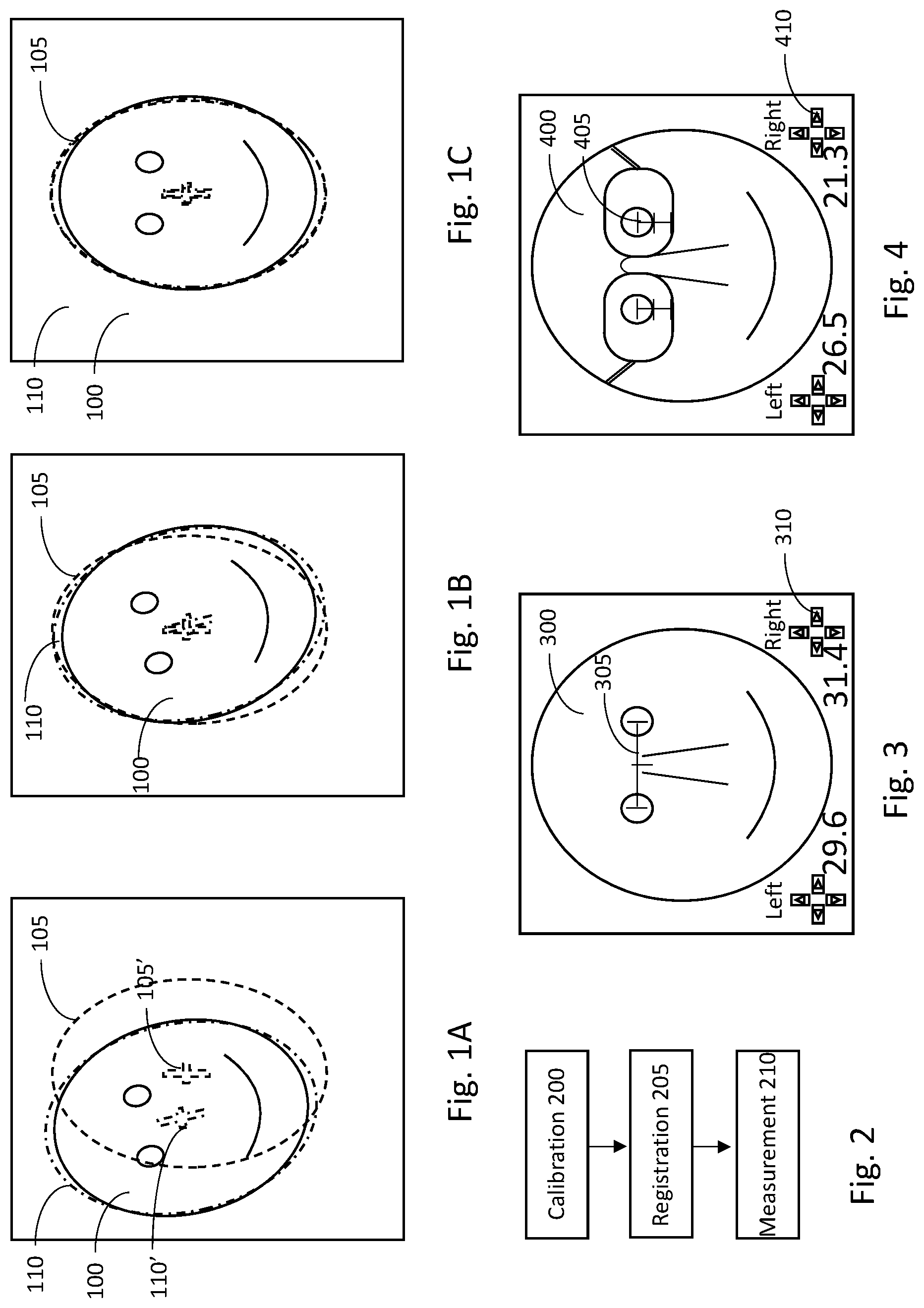 Patent US12310663 Figure 1 – System and method for digital optician measurements