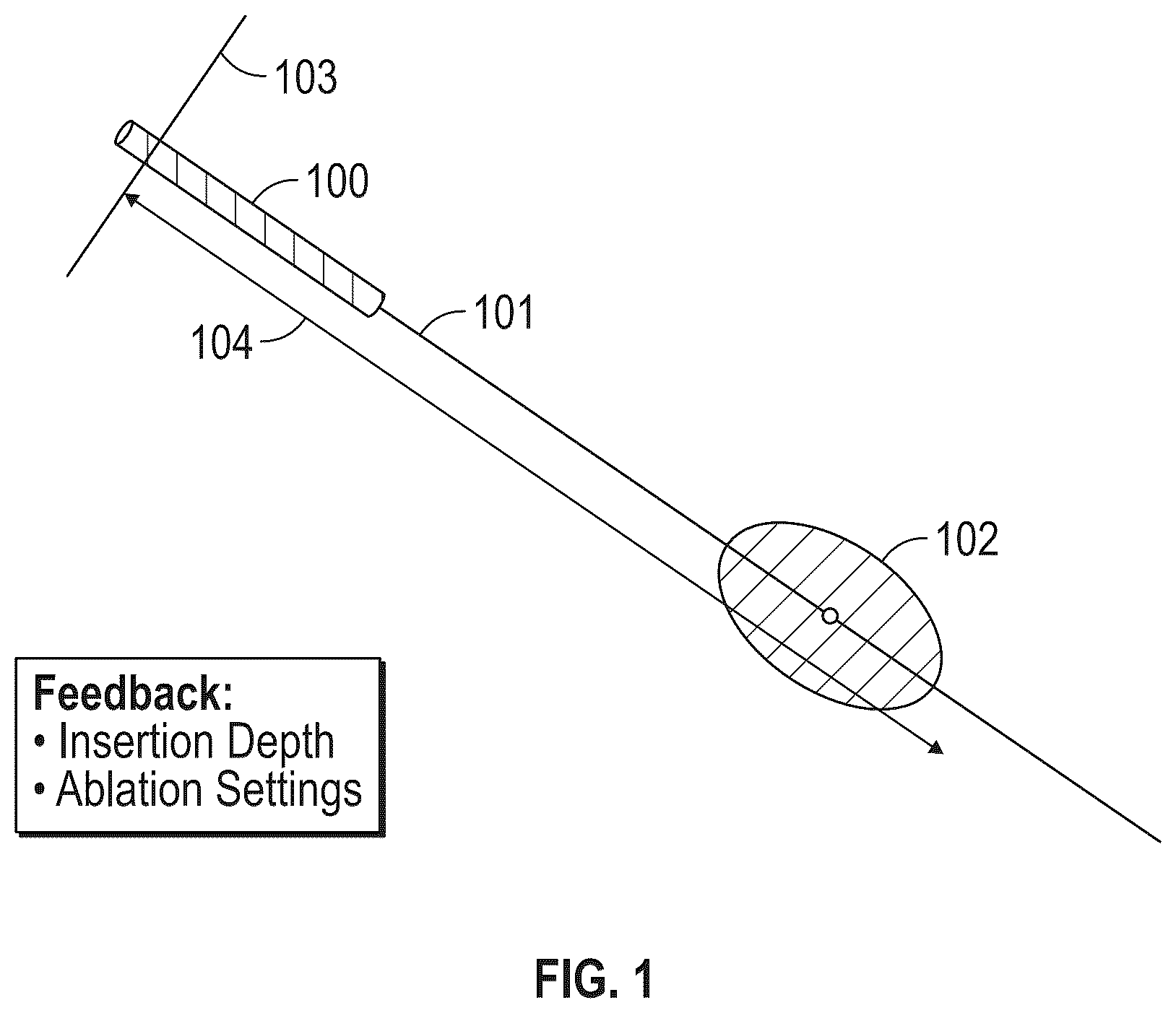 Patent US12310665 Figure 1 – System and method for intra-operative percutaneous ablation planning