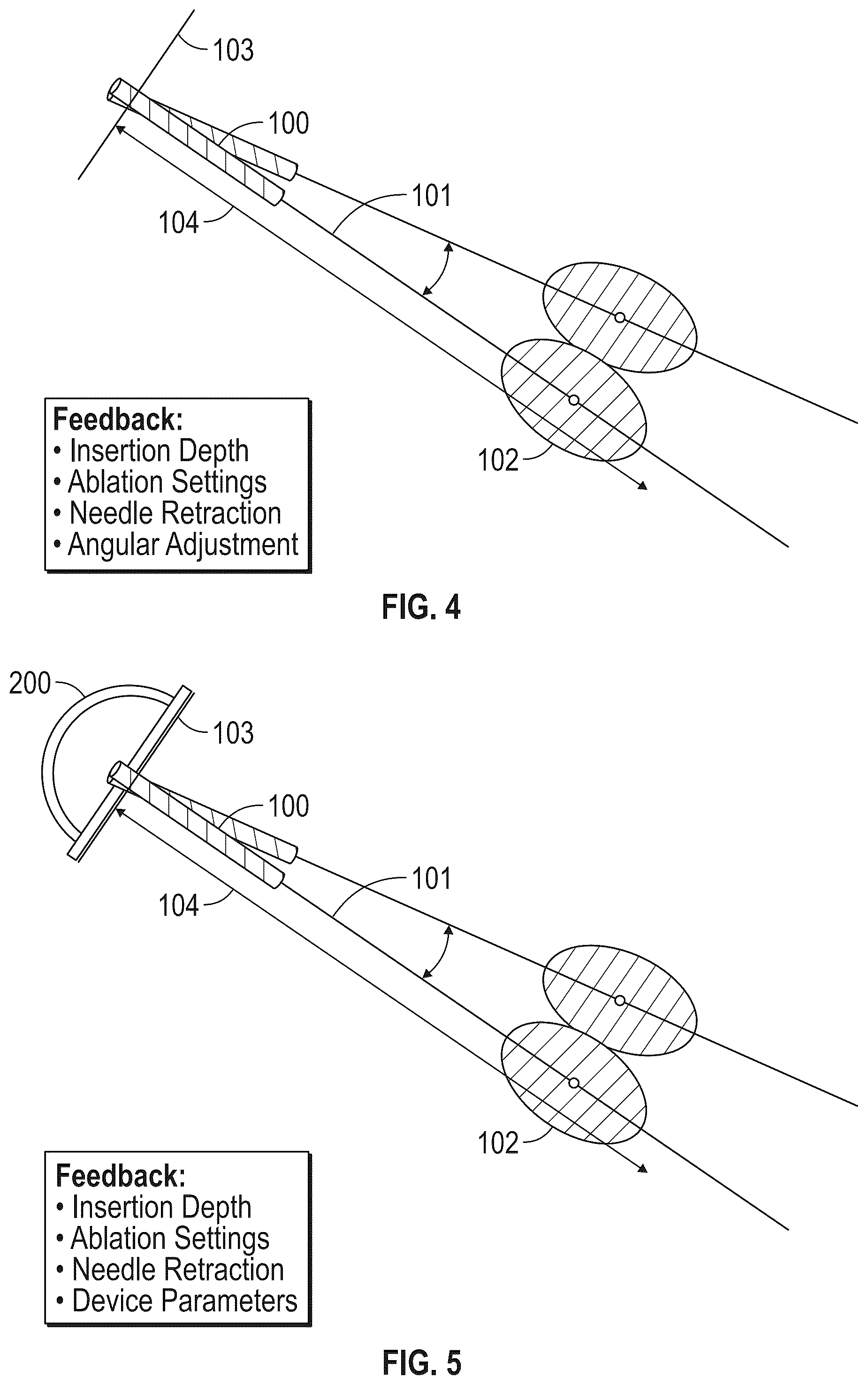 Patent US12310665 Figure 3 – System and method for intra-operative percutaneous ablation planning
