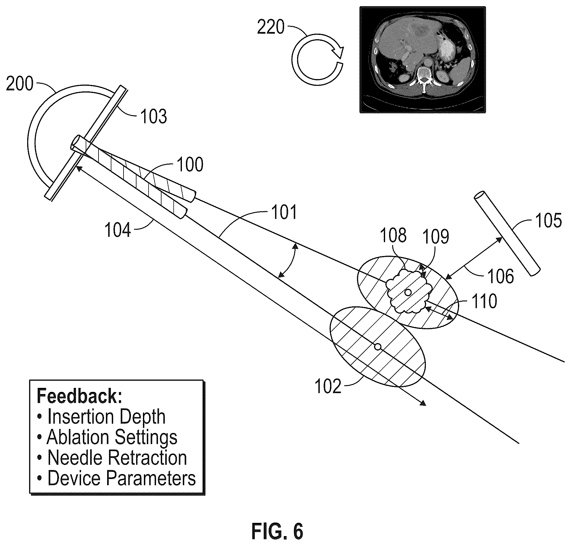 Patent US12310665 Figure 4 – System and method for intra-operative percutaneous ablation planning