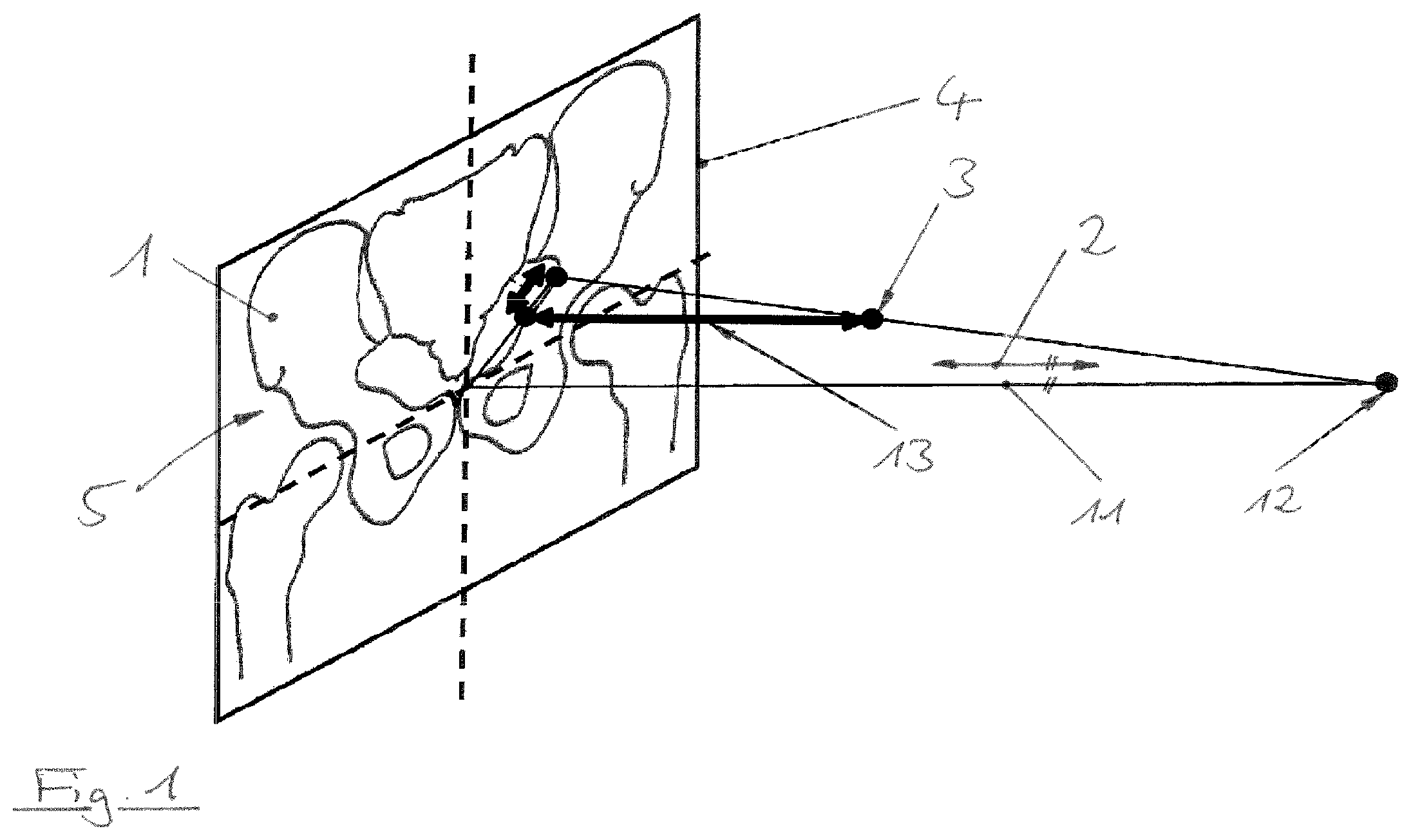 Patent US12310667 Figure 1 – Sagittal rotation determination