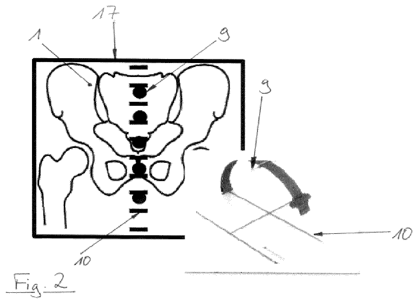 Patent US12310667 Figure 2 – Sagittal rotation determination