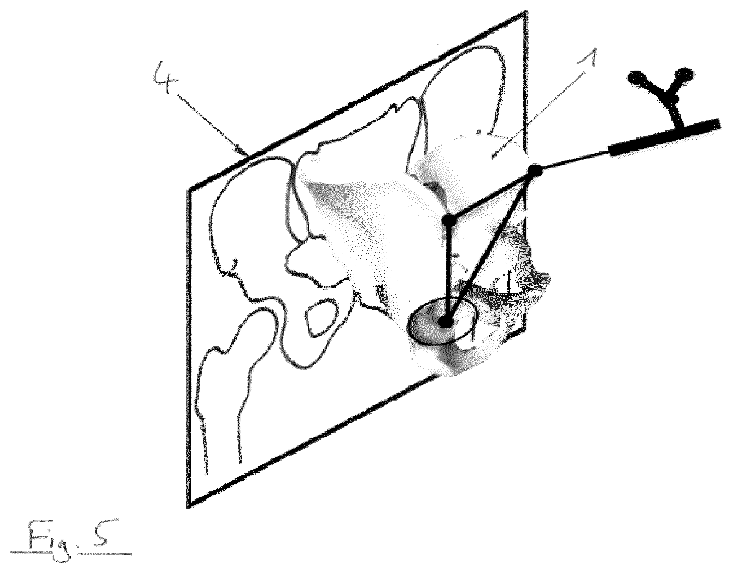 Patent US12310667 Figure 5 – Sagittal rotation determination