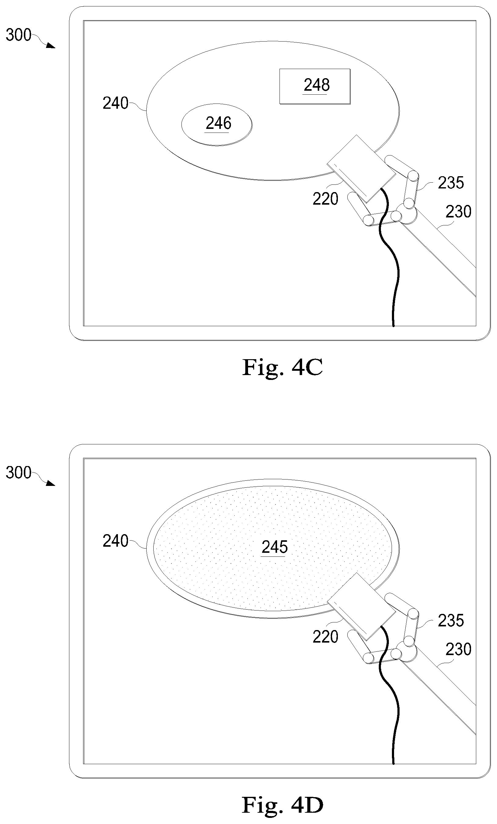Patent US12310670 Figure 10 – System and method related to registration for a medical procedure