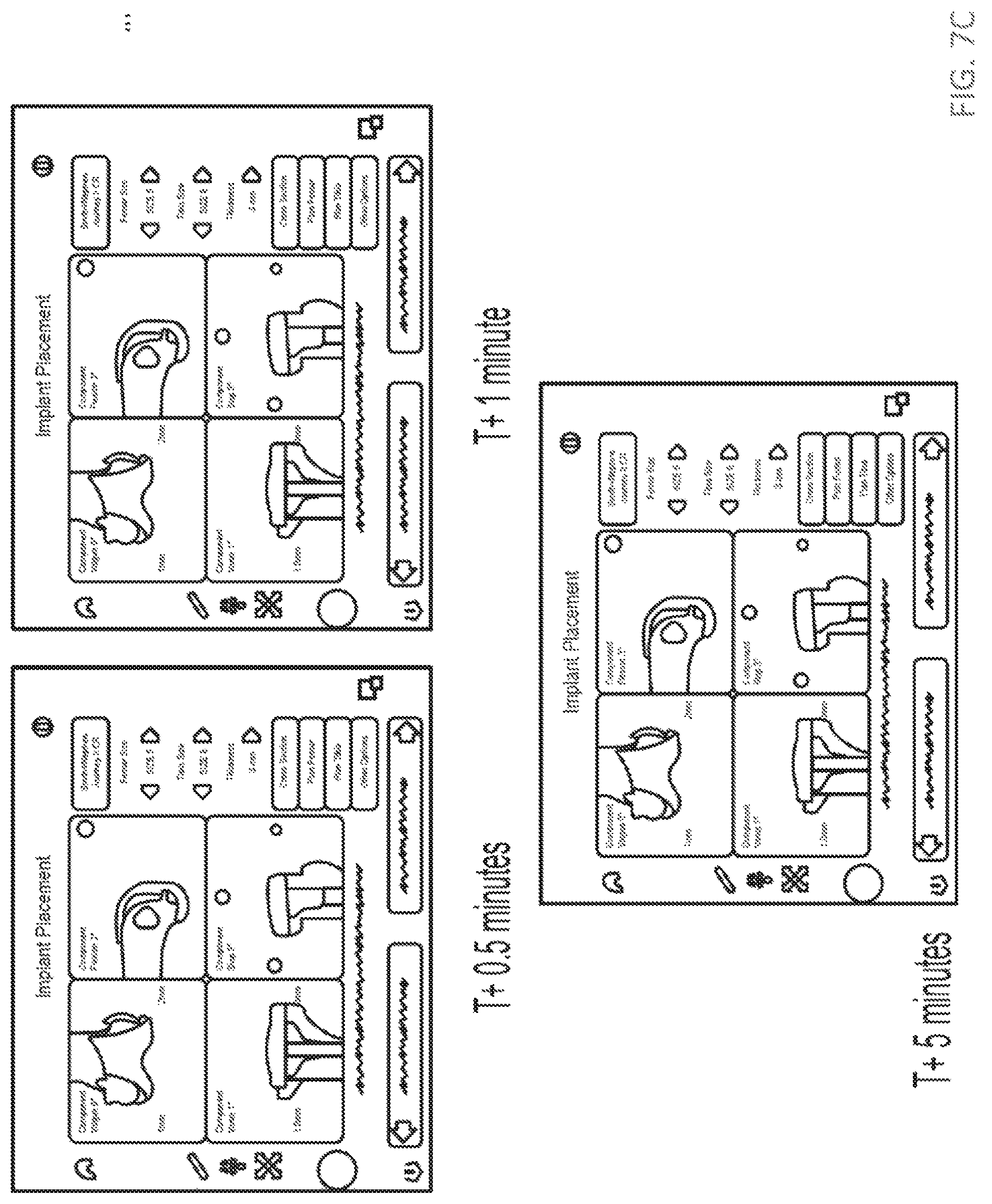 Patent US12310671 Figure 11 – Computer controlled surgical rotary tool